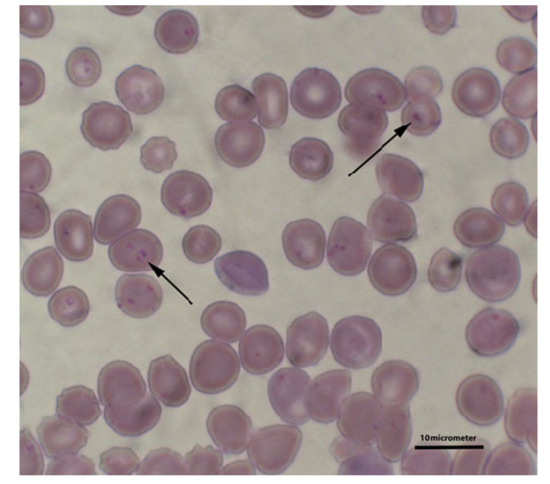 Animals Free Full Text Babesia gibsoni Infection in Dogs mdash