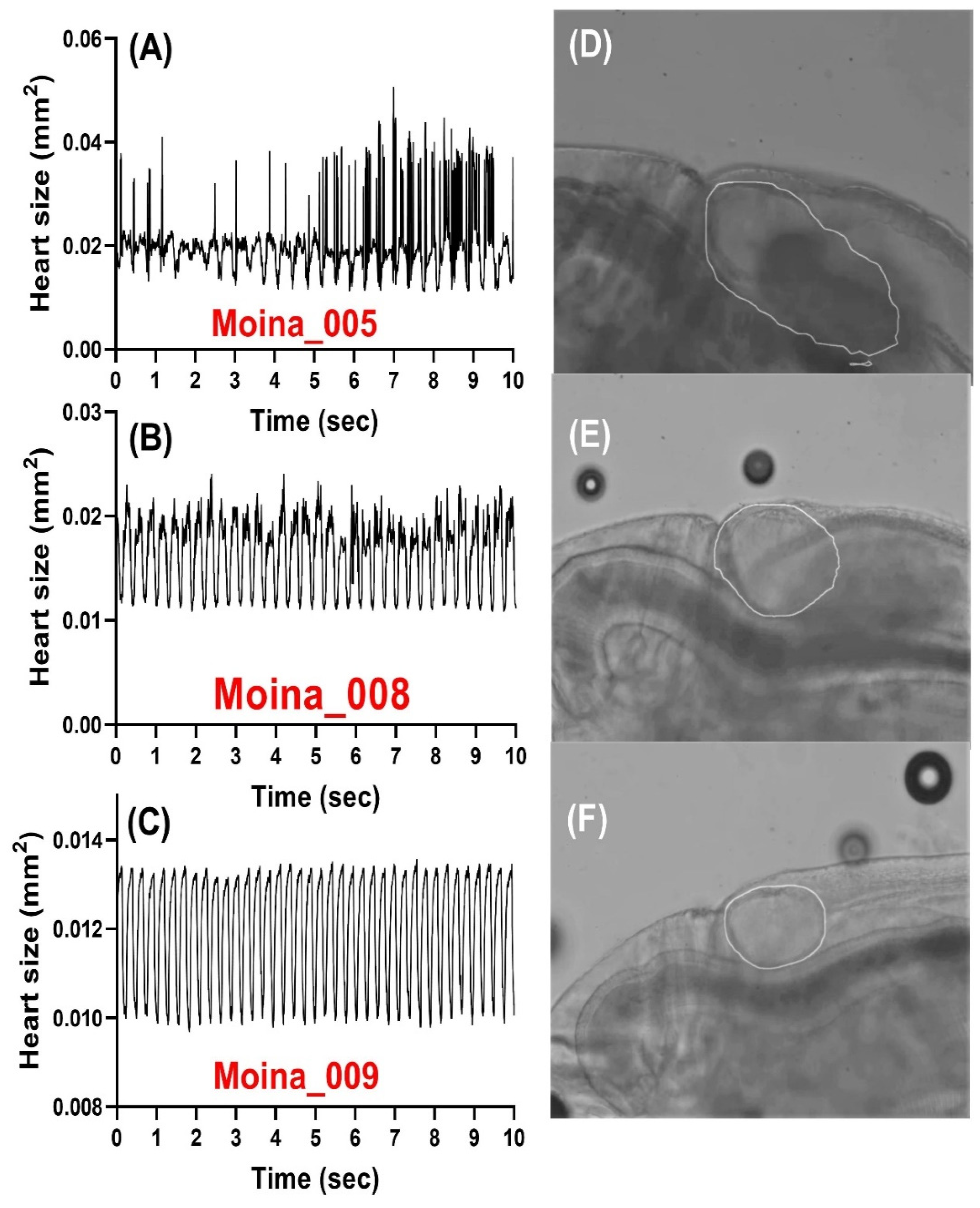 Animals | Free Full-Text | Automated Cardiac Chamber Size and Cardiac Physiology Measurement in Water Fleas by U-Net and Mask RCNN Convolutional Networks Animals | Free Full-Text | Automated Cardiac Chamber Size and Cardiac Physiology Measurement in Water Fleas by U-Net and Mask RCNN Convolutional Networks