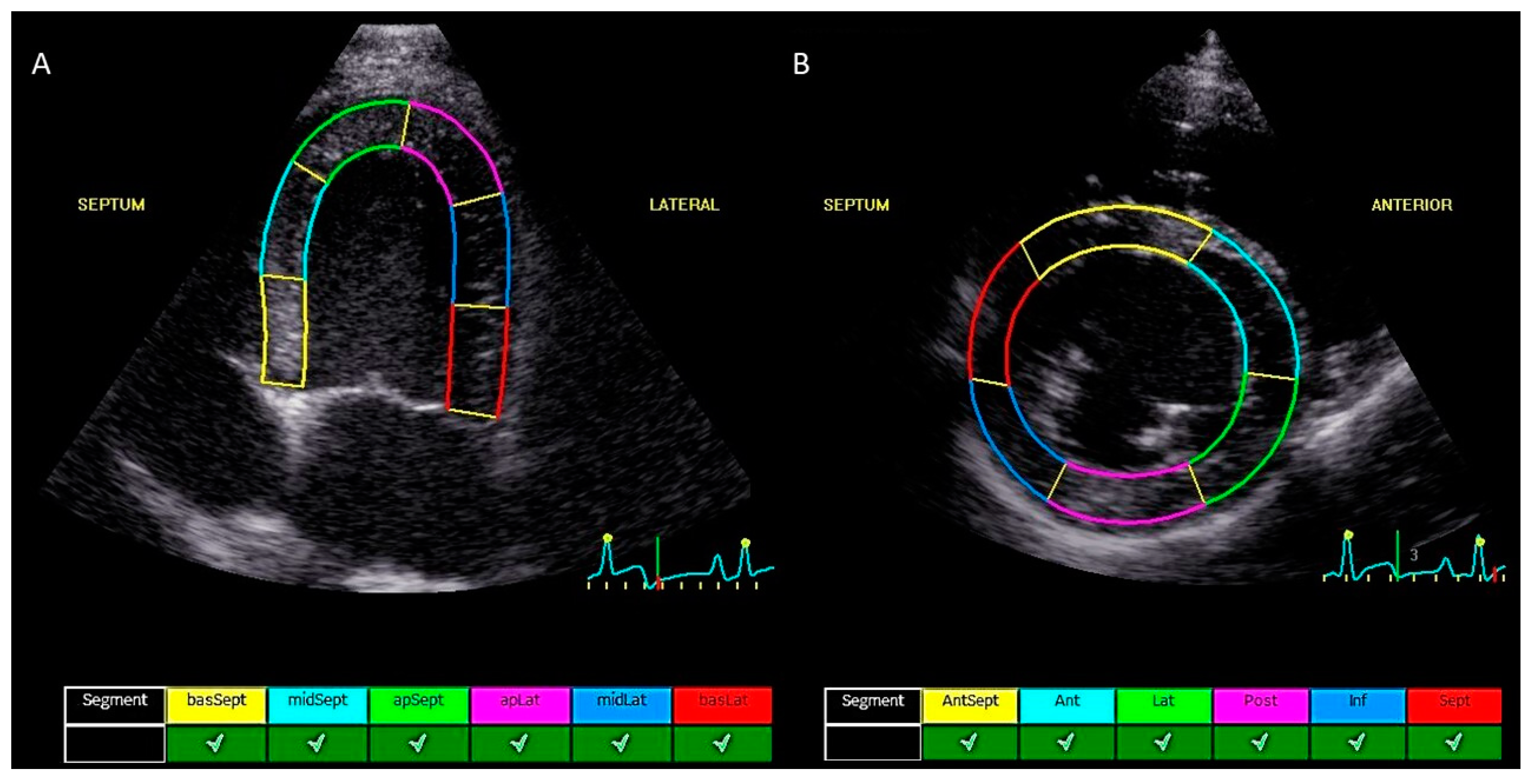 Animals Free FullText Assessment of Cardiotoxicity after a Single