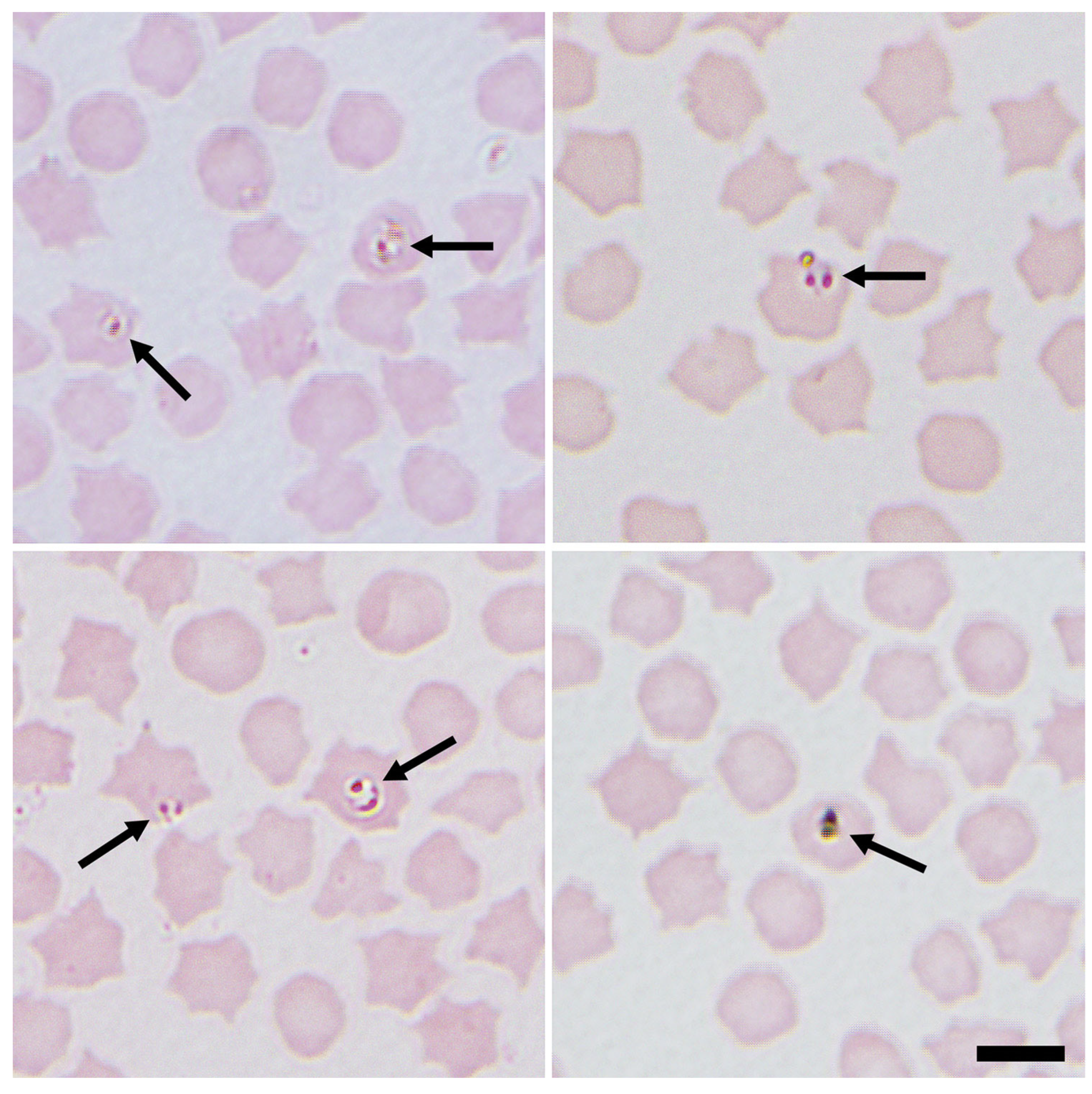 Animals | Free Full-Text | Anaemia in Sheep Caused by Babesia and Theileria  Haemoparasites