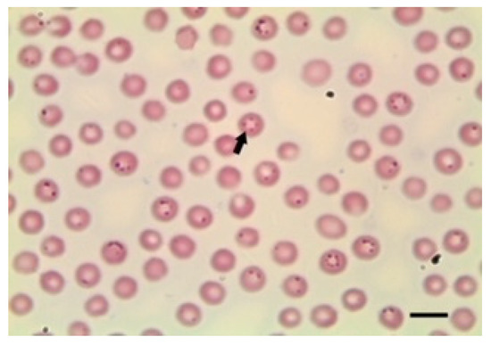 Animals | Free Full-Text | Anaemia in Sheep Caused by Babesia and Theileria  Haemoparasites