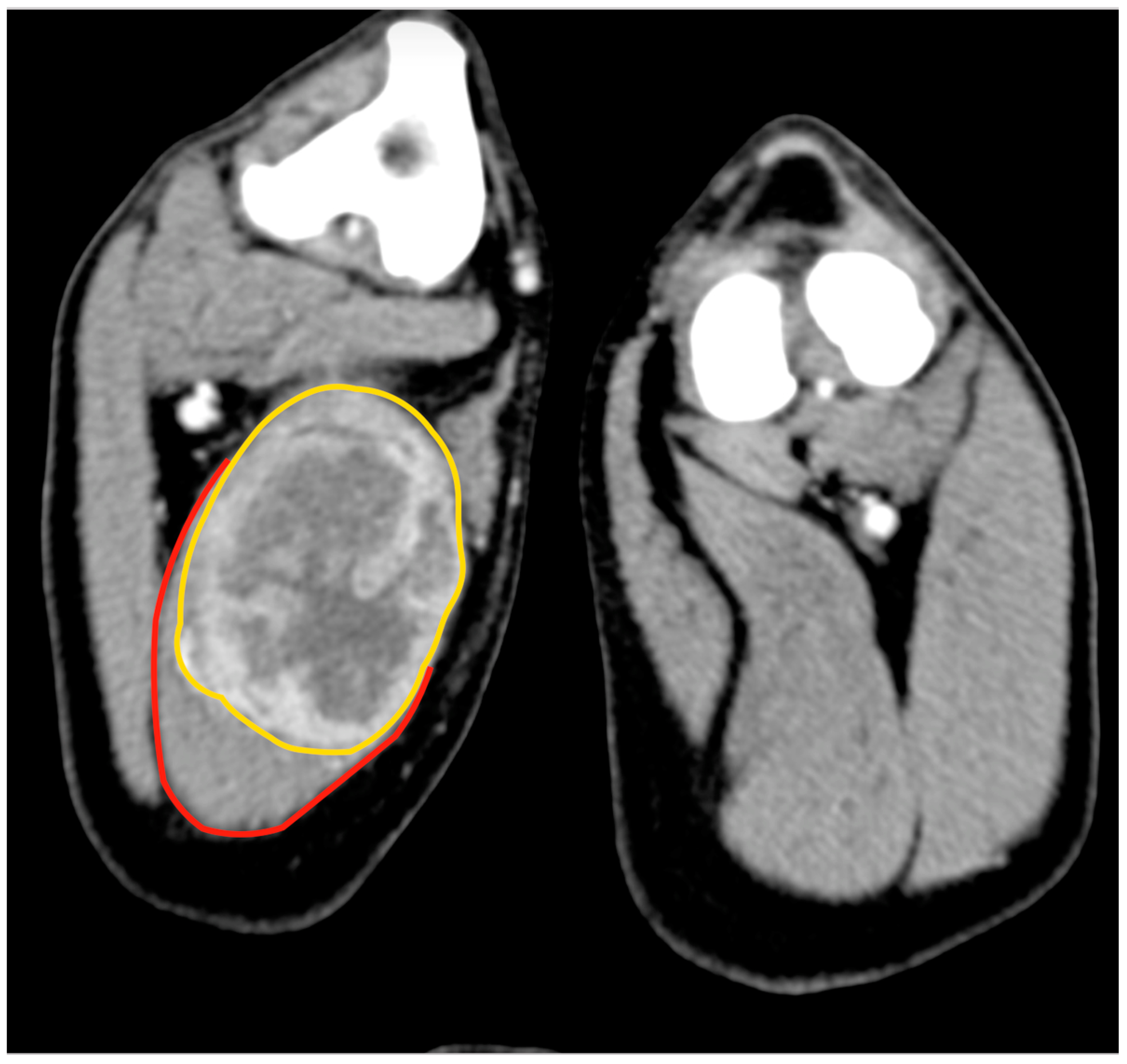 Animals | Free Full-Text | Surgical Excision of Intramuscular Sarcomas ...