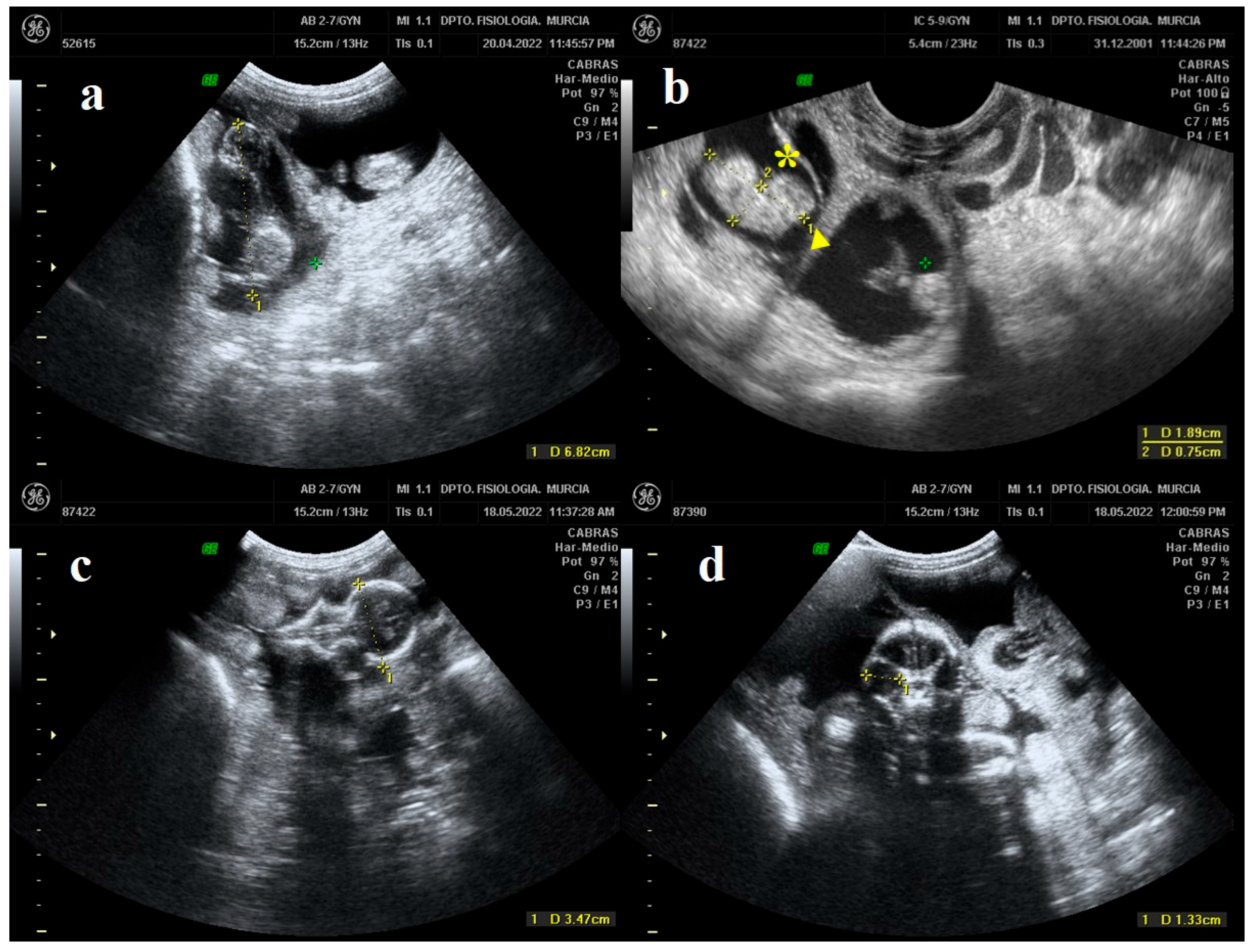 Animals Free Full-Text Ultrasonography of Pregnancy in Murciano-Granadina Goat Breed Fetal Growth Indices and Umbilical Artery Doppler Parameters pic