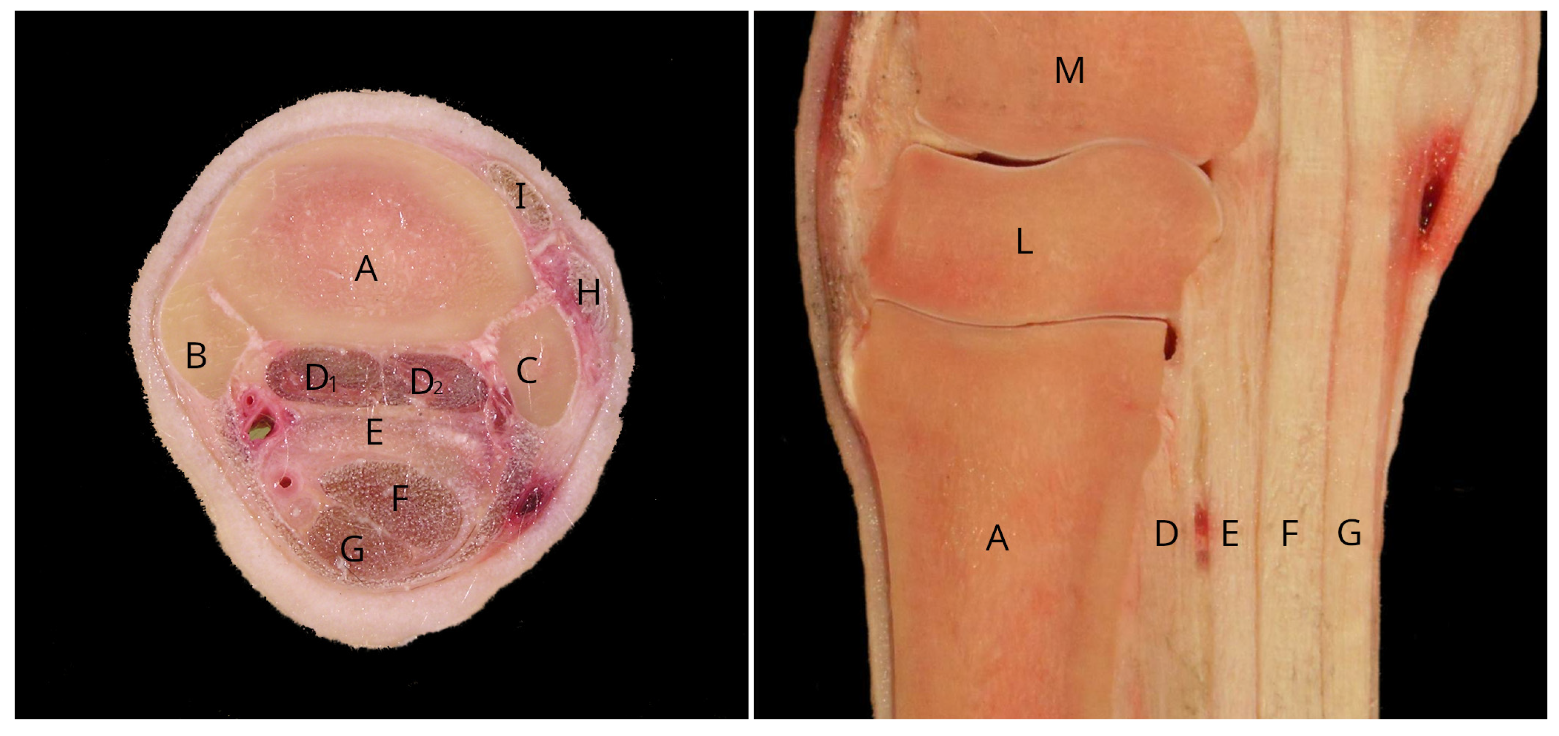 PDF) Topographic Description of Metacarpal Tendons and Ligaments of Anatoly  Donkey by Ultrasonography and Introducing a New Ligament