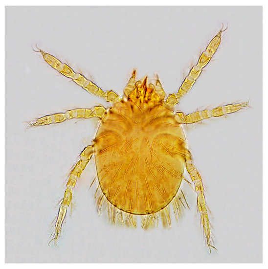Comparison of Chiggers (Acari: Trombiculidae