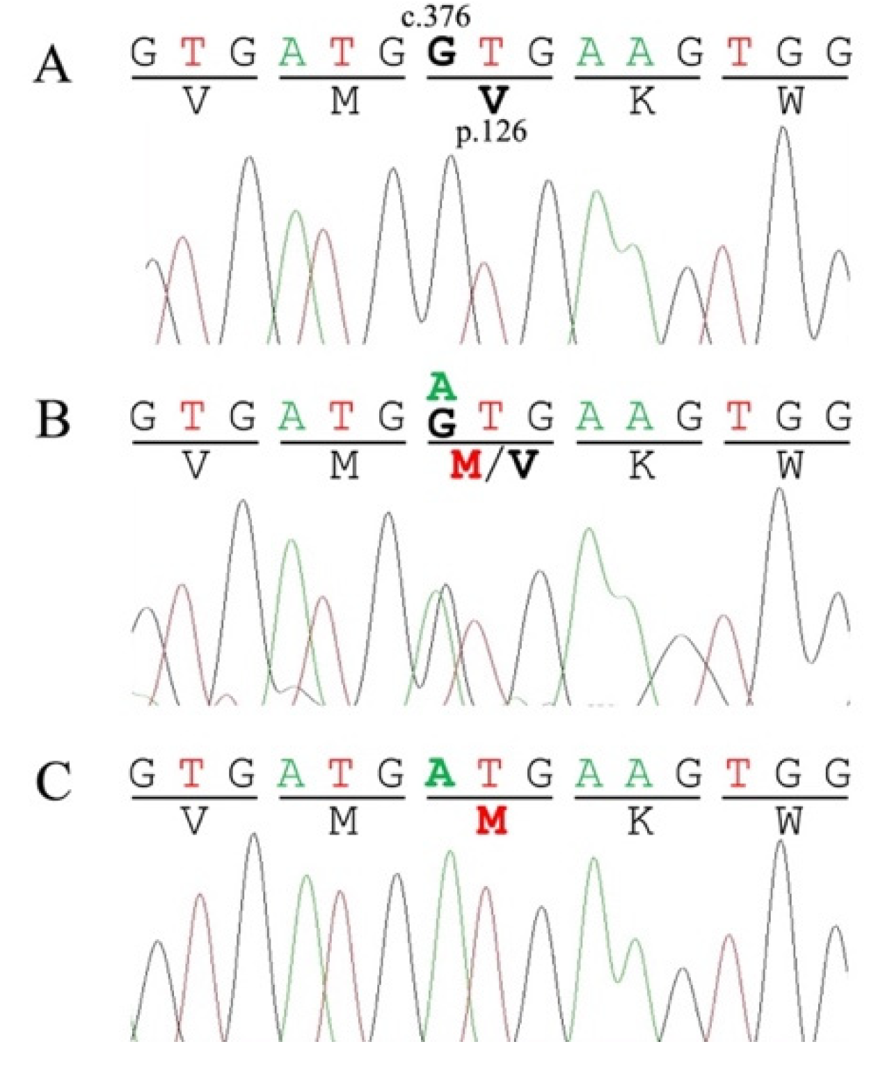 A new regulatory mechanism of STARD1 in Niemann-Pick disease type C (NPC),  discovered