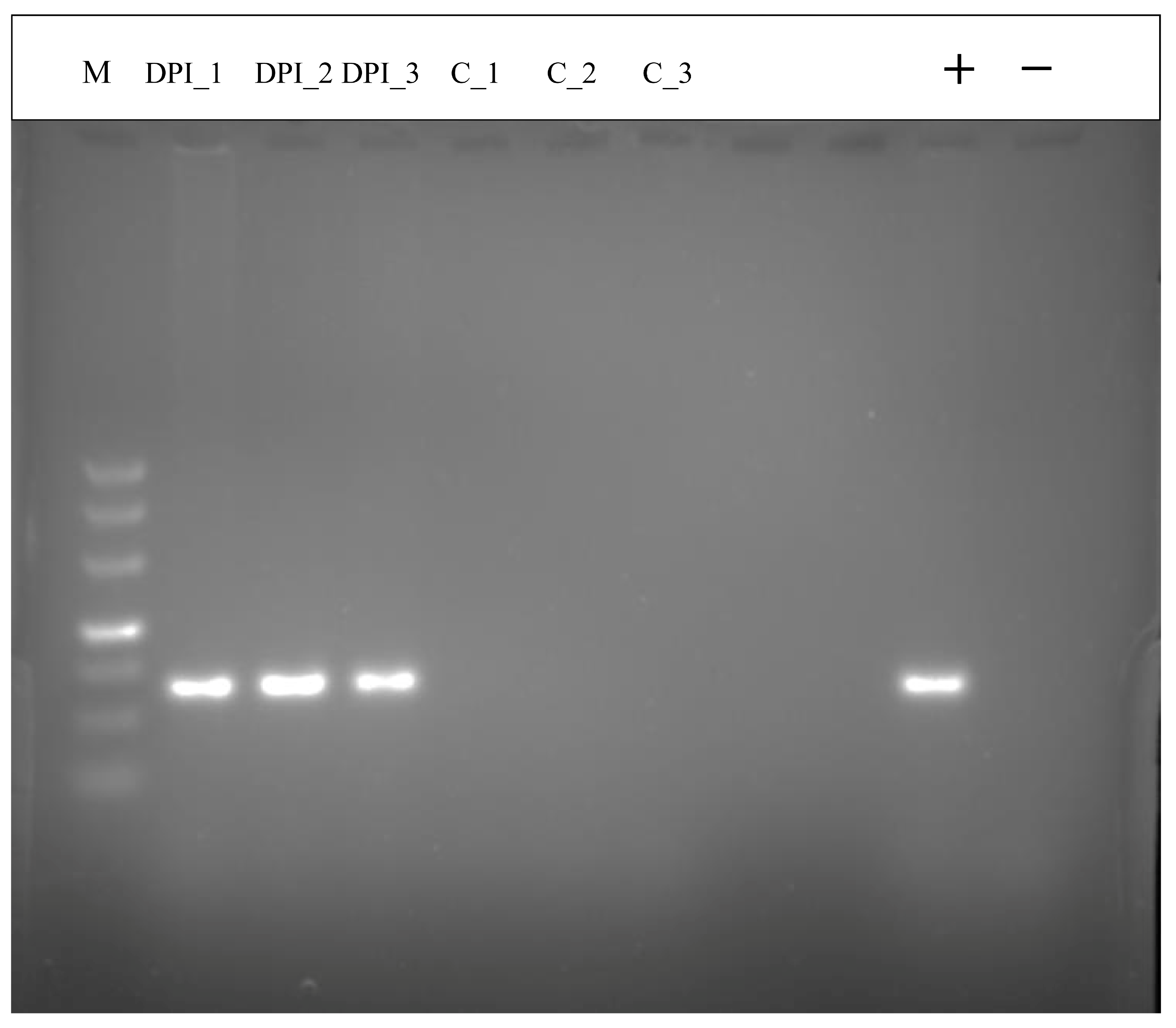 iTRAQ-Based Phosphoproteomic Analysis Exposes Molecular