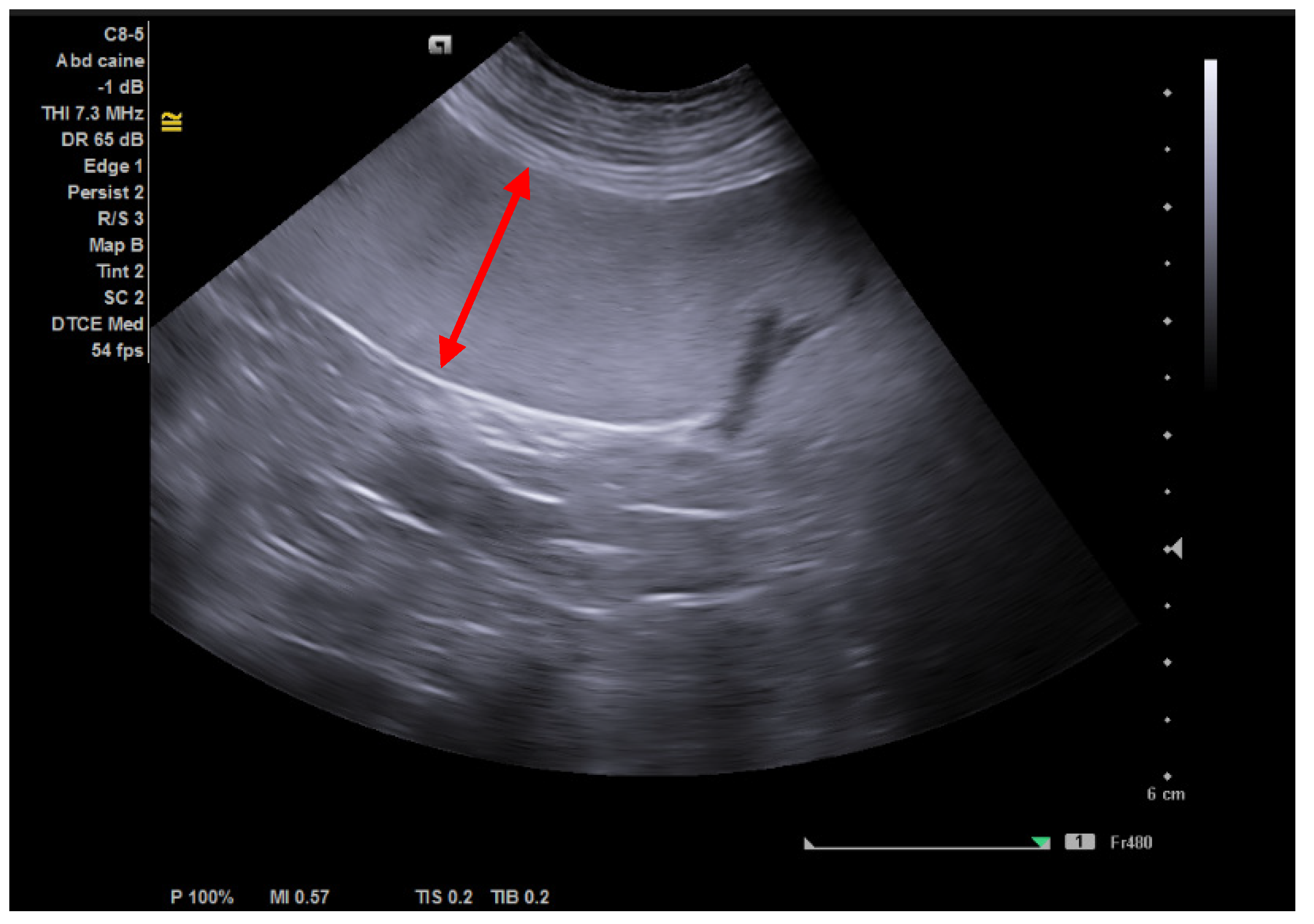 Strategies for the Diagnosis of Granulocytic Anaplasmosis in Two Naturally Infected Dogs