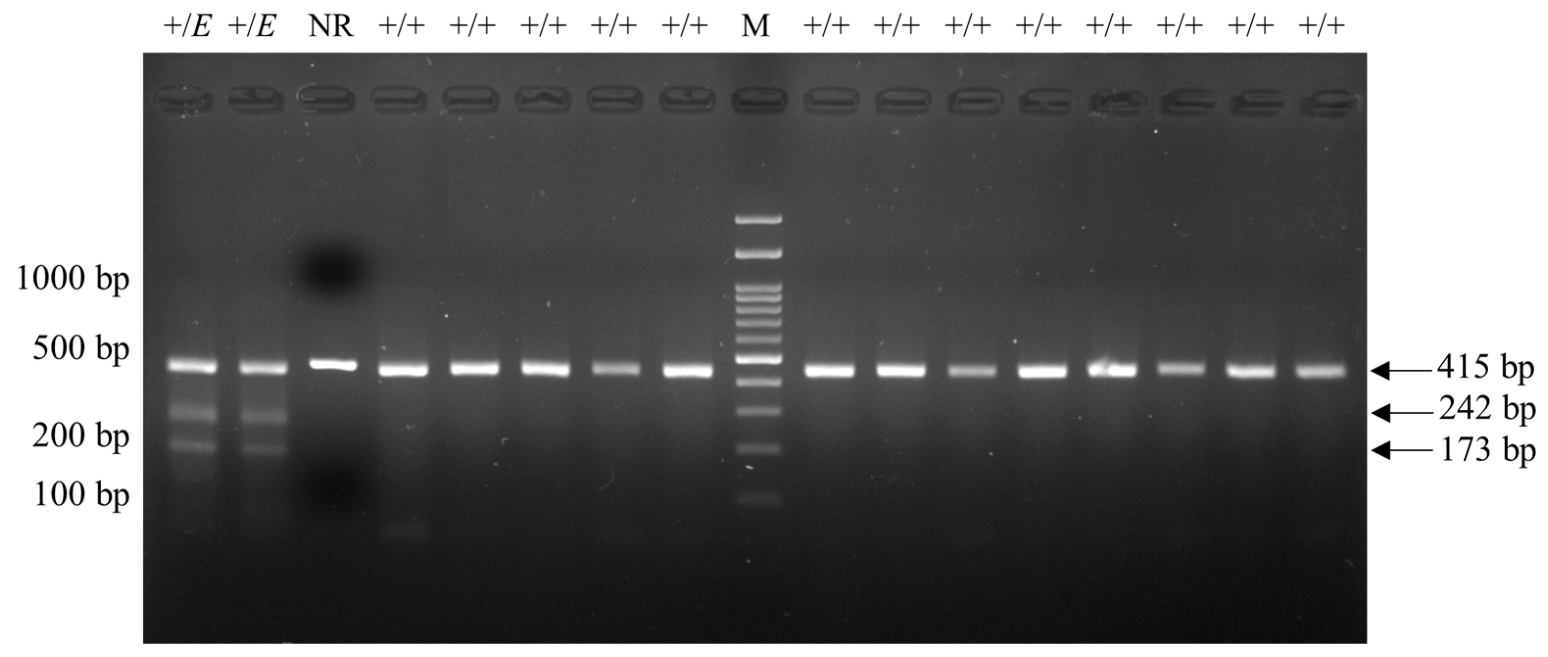 Detection of Booroola Polymorphism of Bone Morphogenetic Detection of Booroola Polymorphism of Bone Morphogenetic