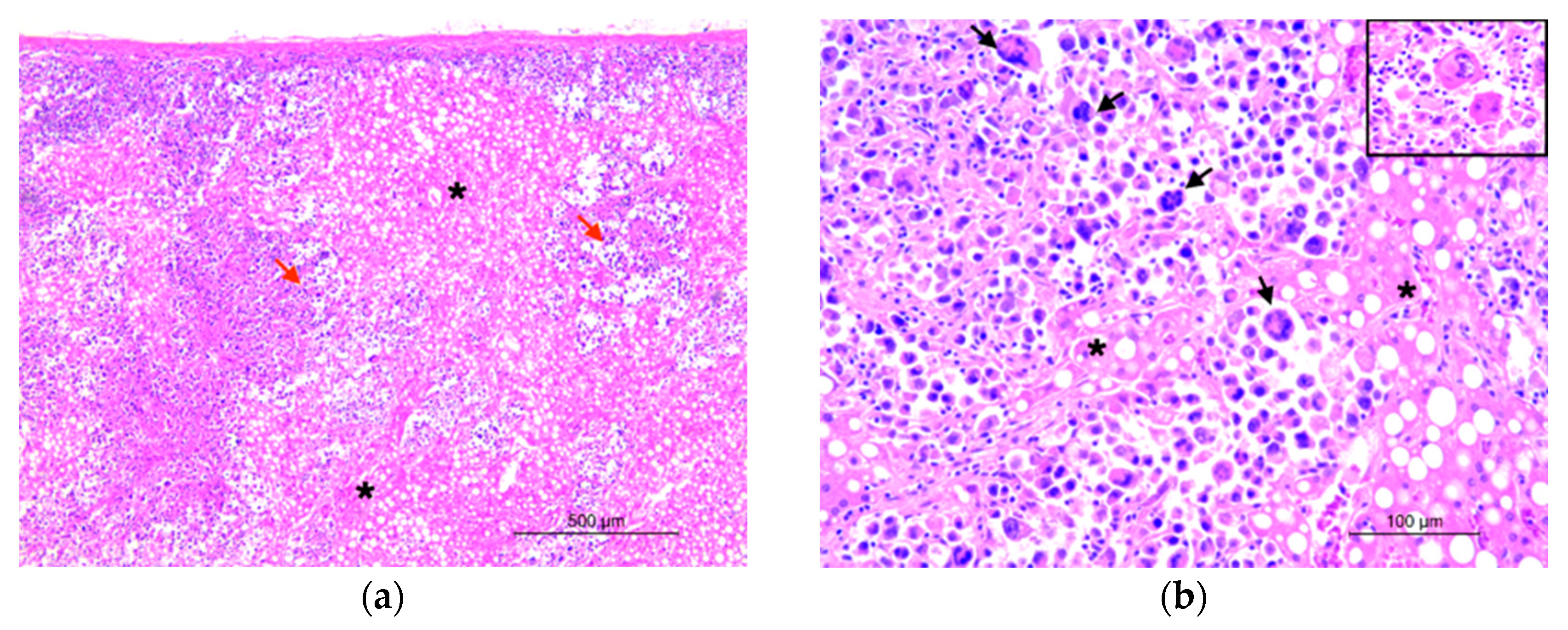 Histiocytic Sarcoma in a Captive Hybrid Orangutan (Pongo sp