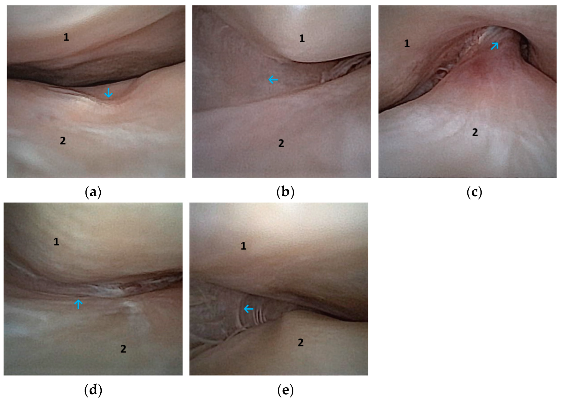 Animals 14 01338 g005