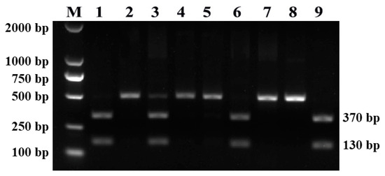 Molecular Identification and Survey of Cyclospora spp. in