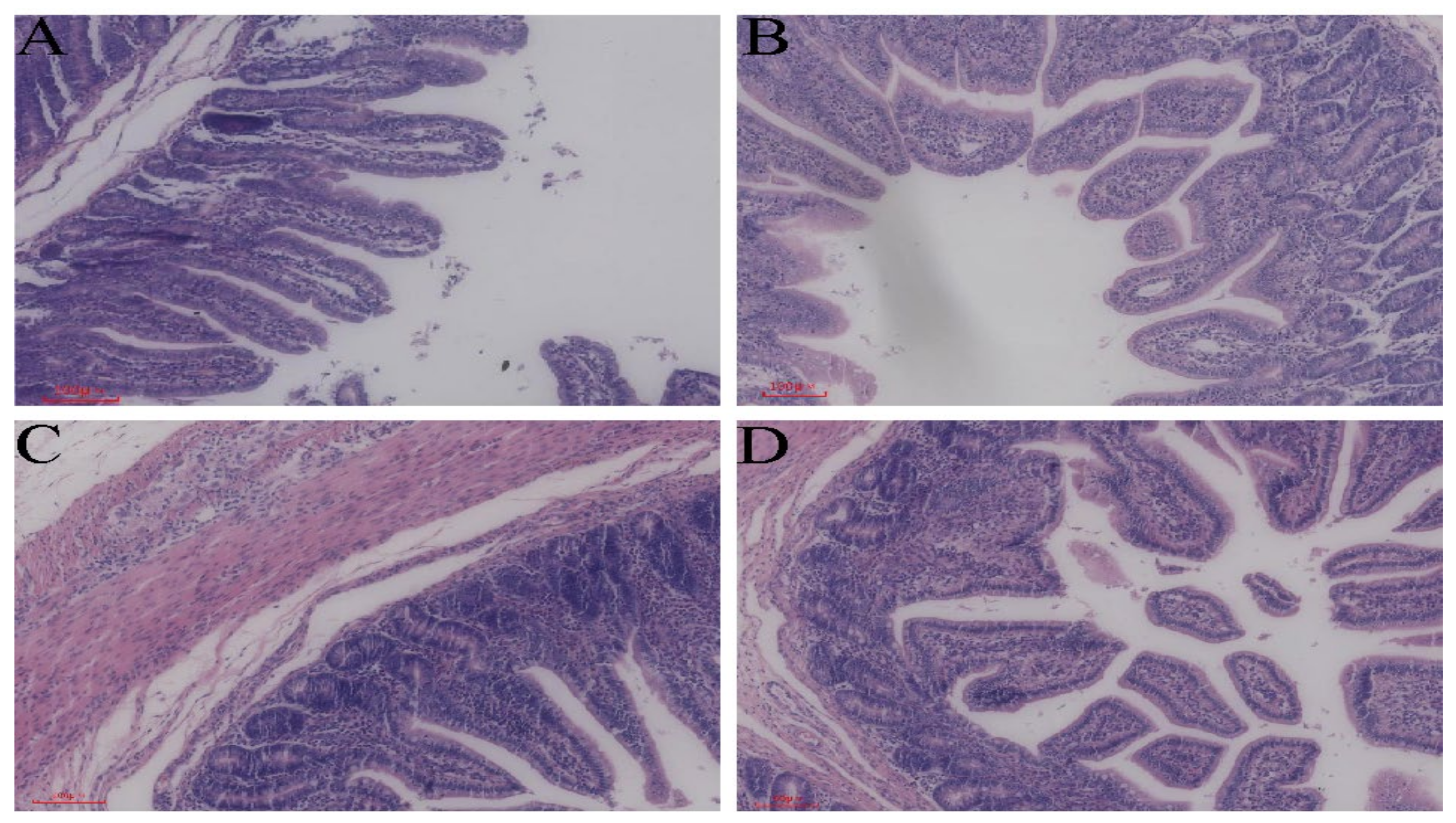 Macrogenomic and Metabolomic Analyses Reveal Mechanisms of