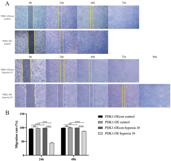 Study on the Regulatory Mechanism of the PDK1-Mediated TGF-β/Smad