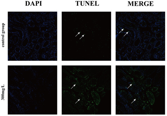 Transcriptome Analysis Reveals Immune and Antioxidant