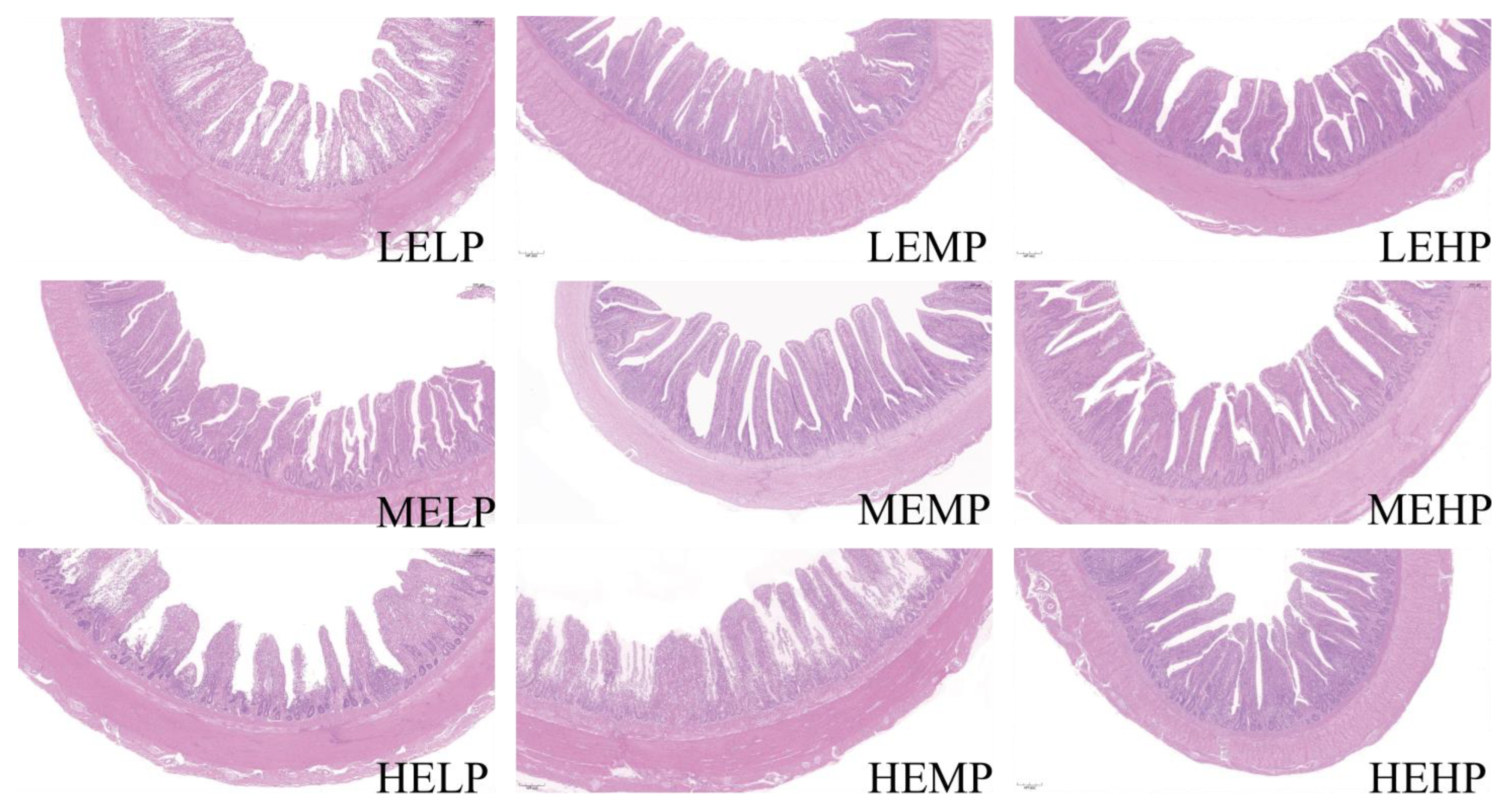 Effects of Dietary Metabolizable Energy and Crude Protein Levels