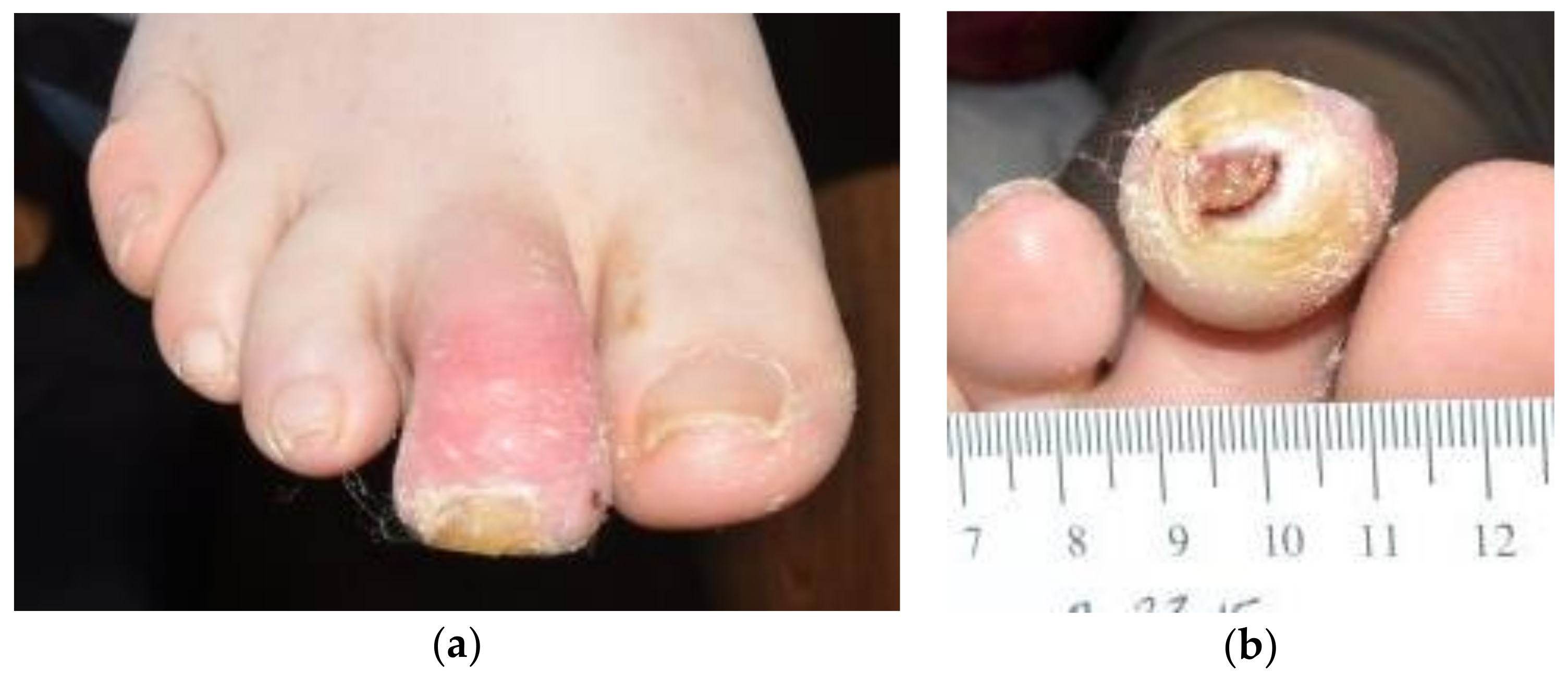 Antibiotics 07 00087 g001