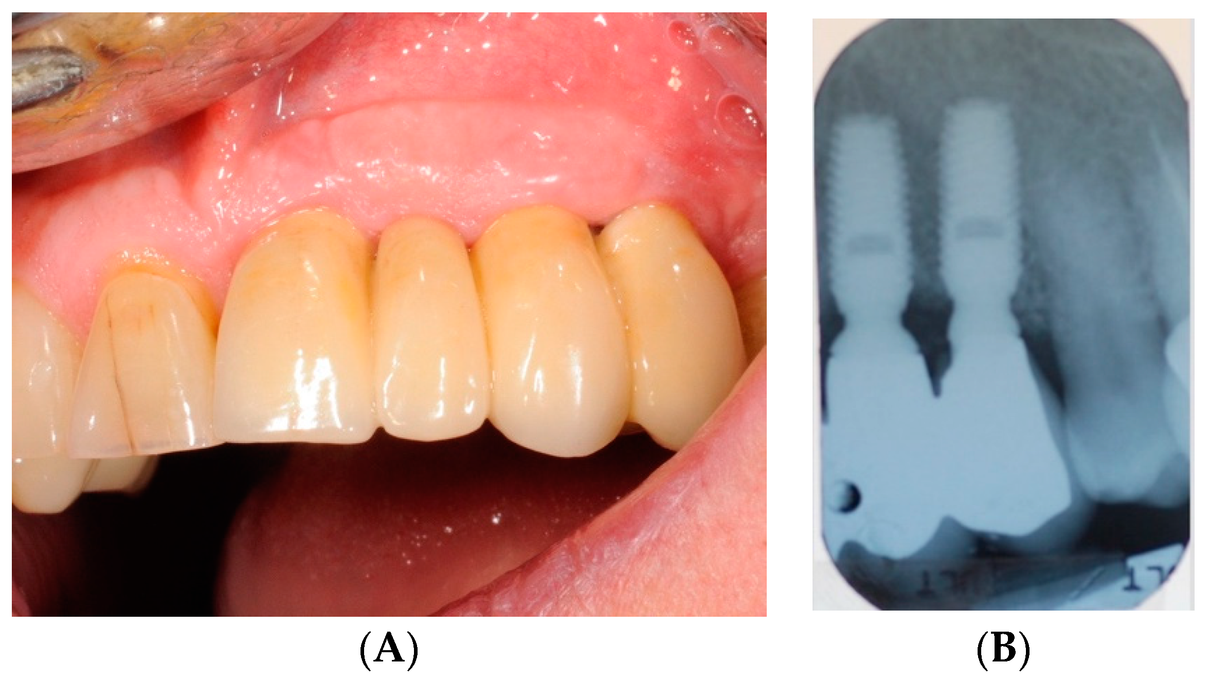 Antibiotics 08 00082 g004 Antibiotics 08 00082 g004