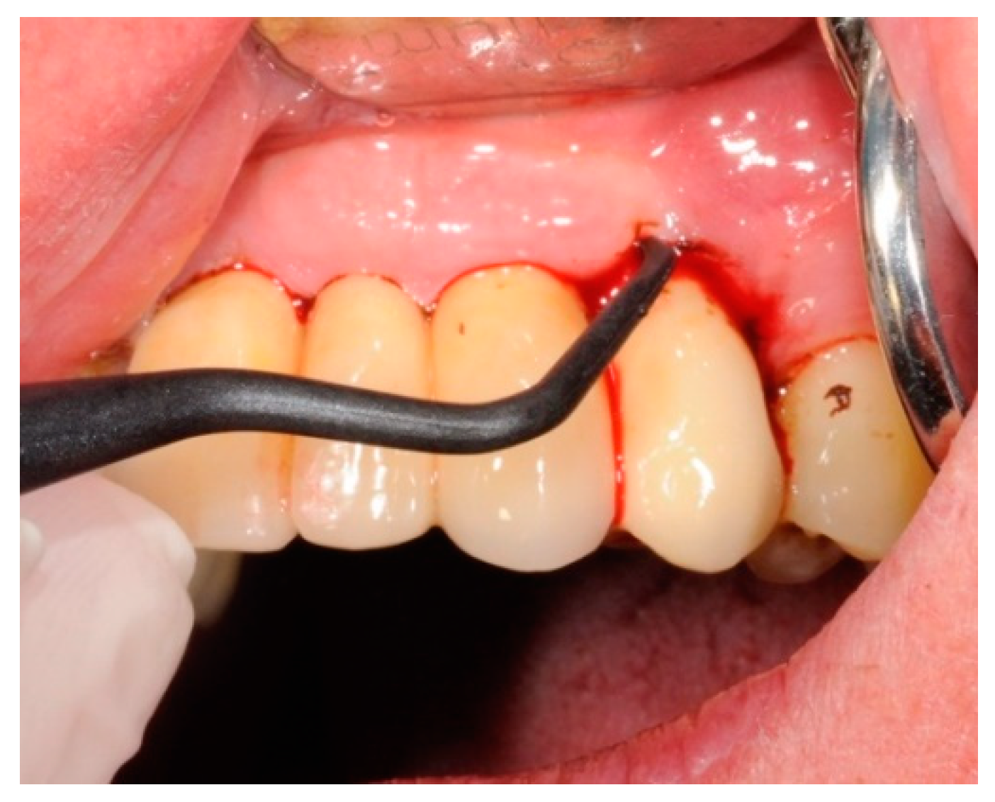 Antibiotics 08 00082 g007 Antibiotics 08 00082 g007