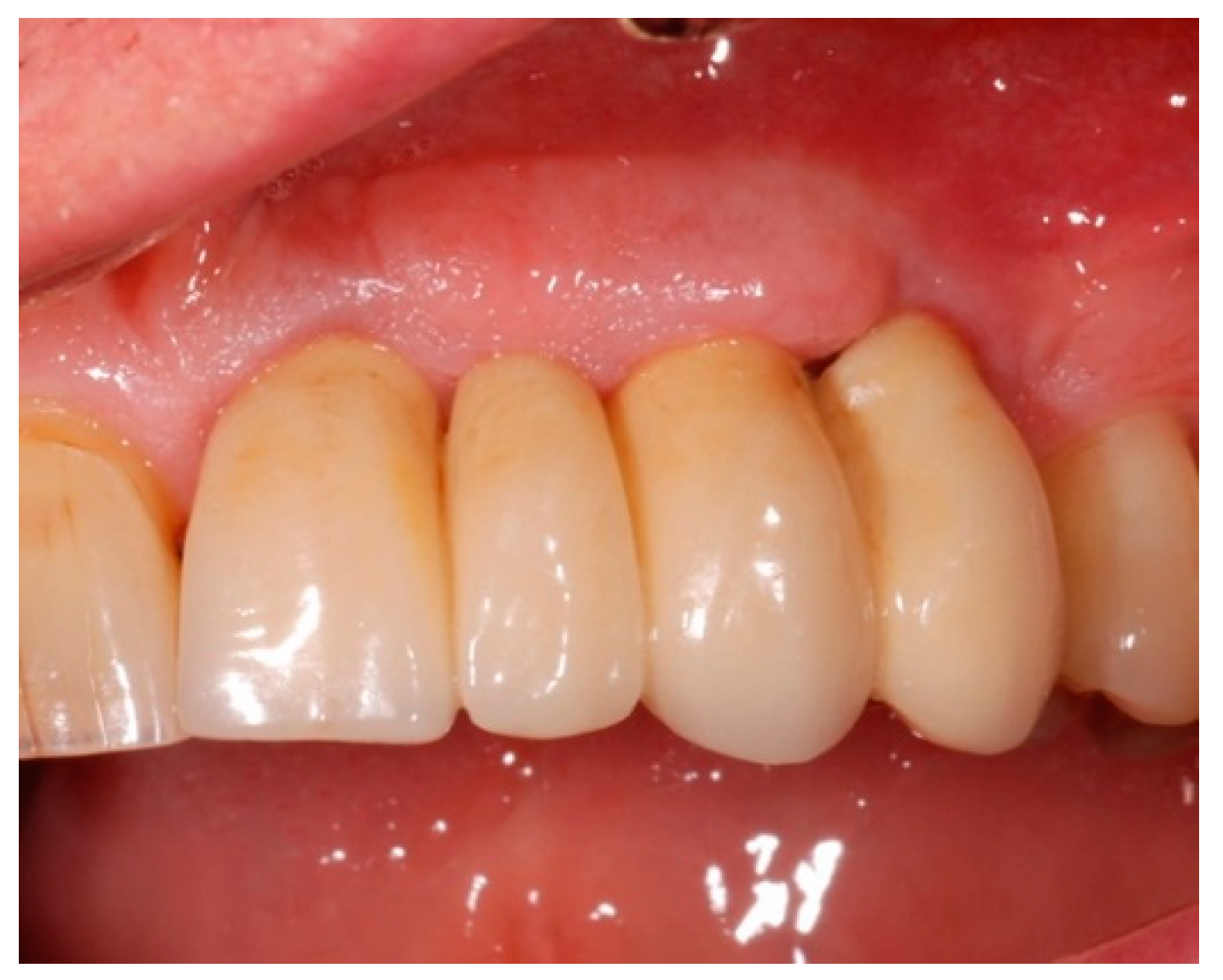 Antibiotics 08 00082 g008 Antibiotics 08 00082 g008