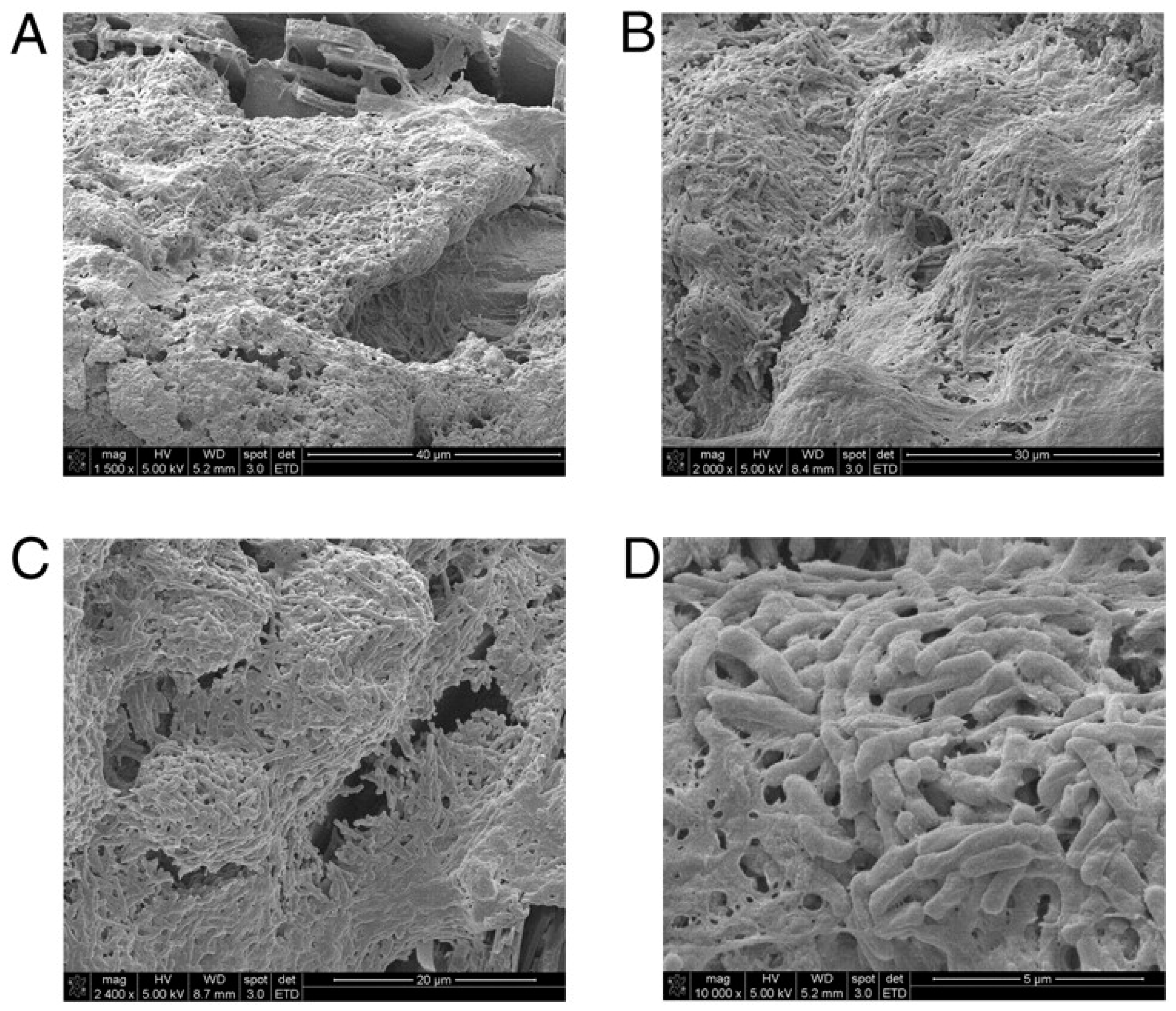 Antibiotics Free Full Text Bacterial Biofilm And Its Role In The Pathogenesis Of Disease Html