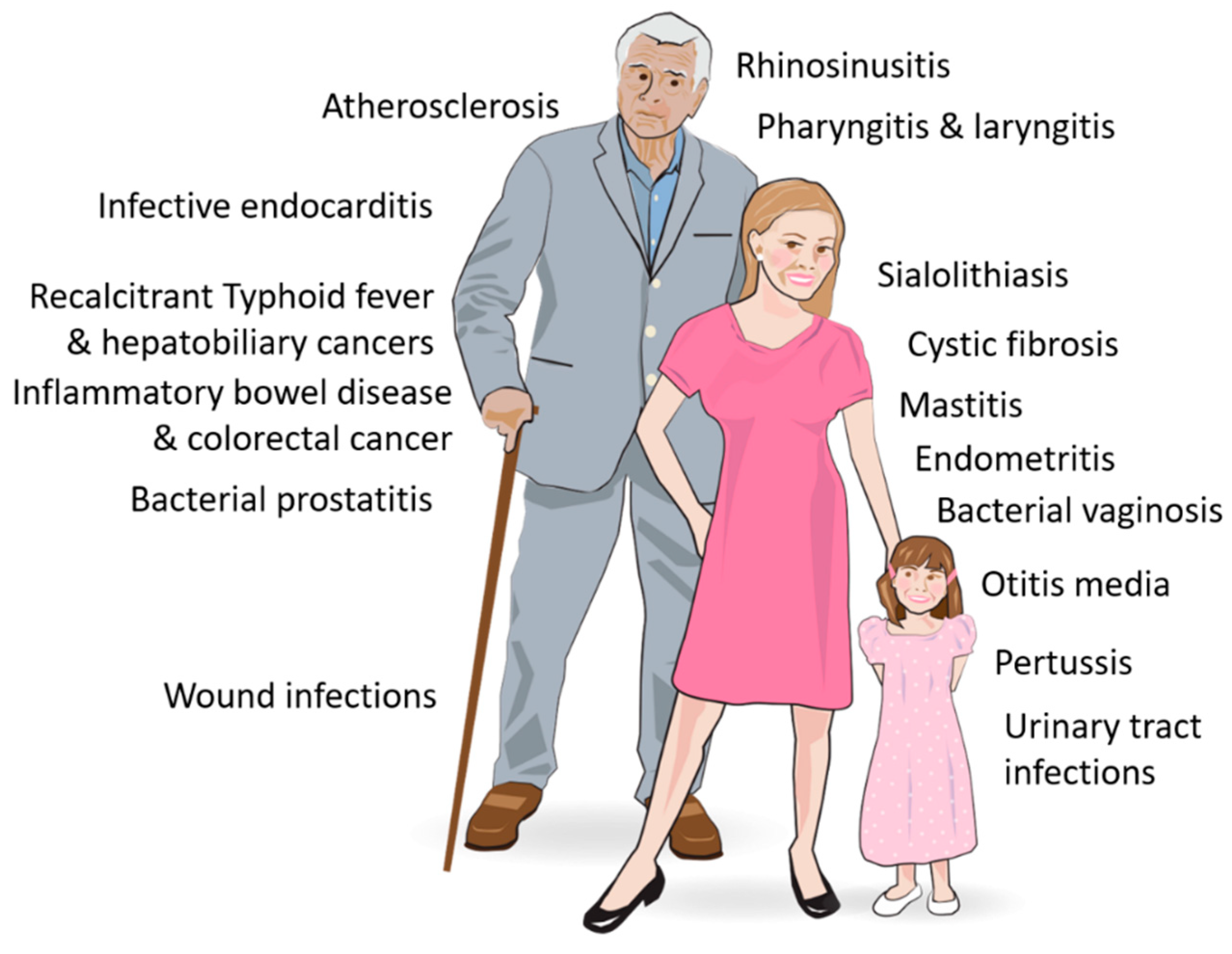 A prosztata antibiotikumok gyulladása