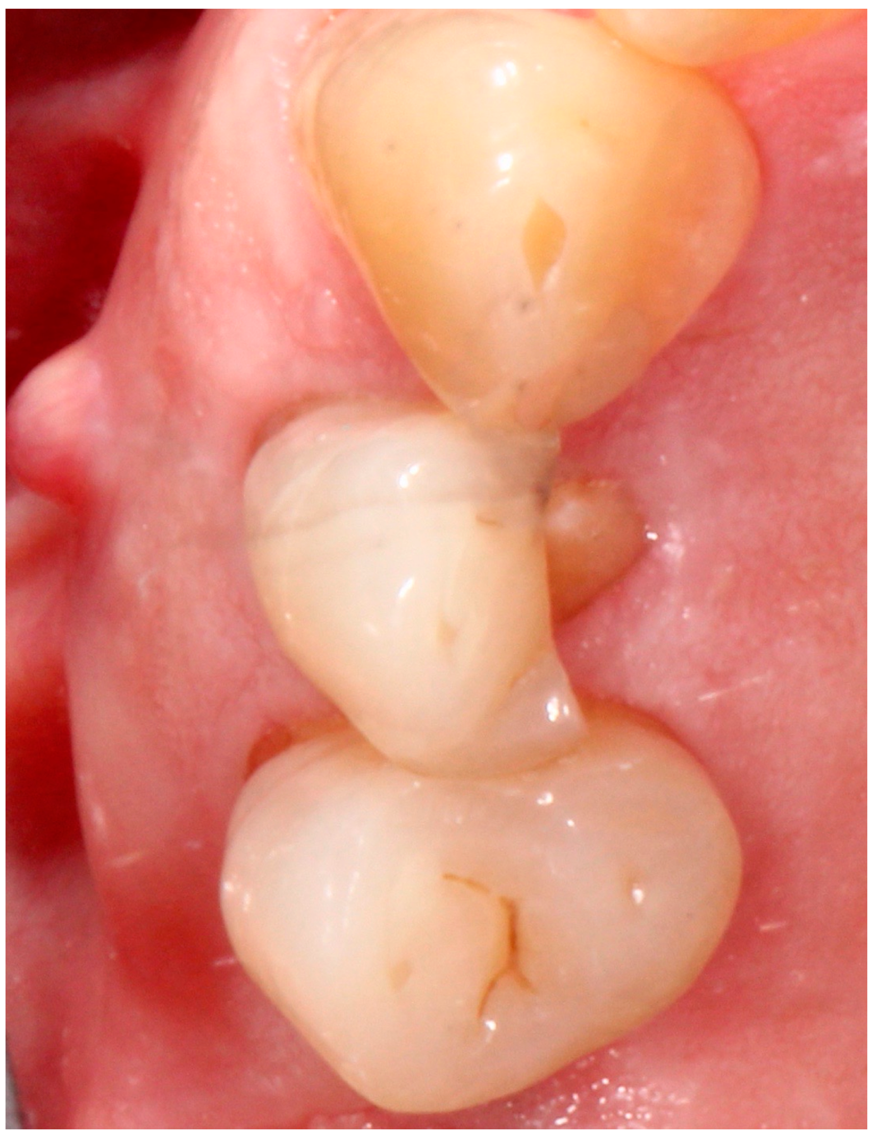 Antibiotics 09 00110 g001