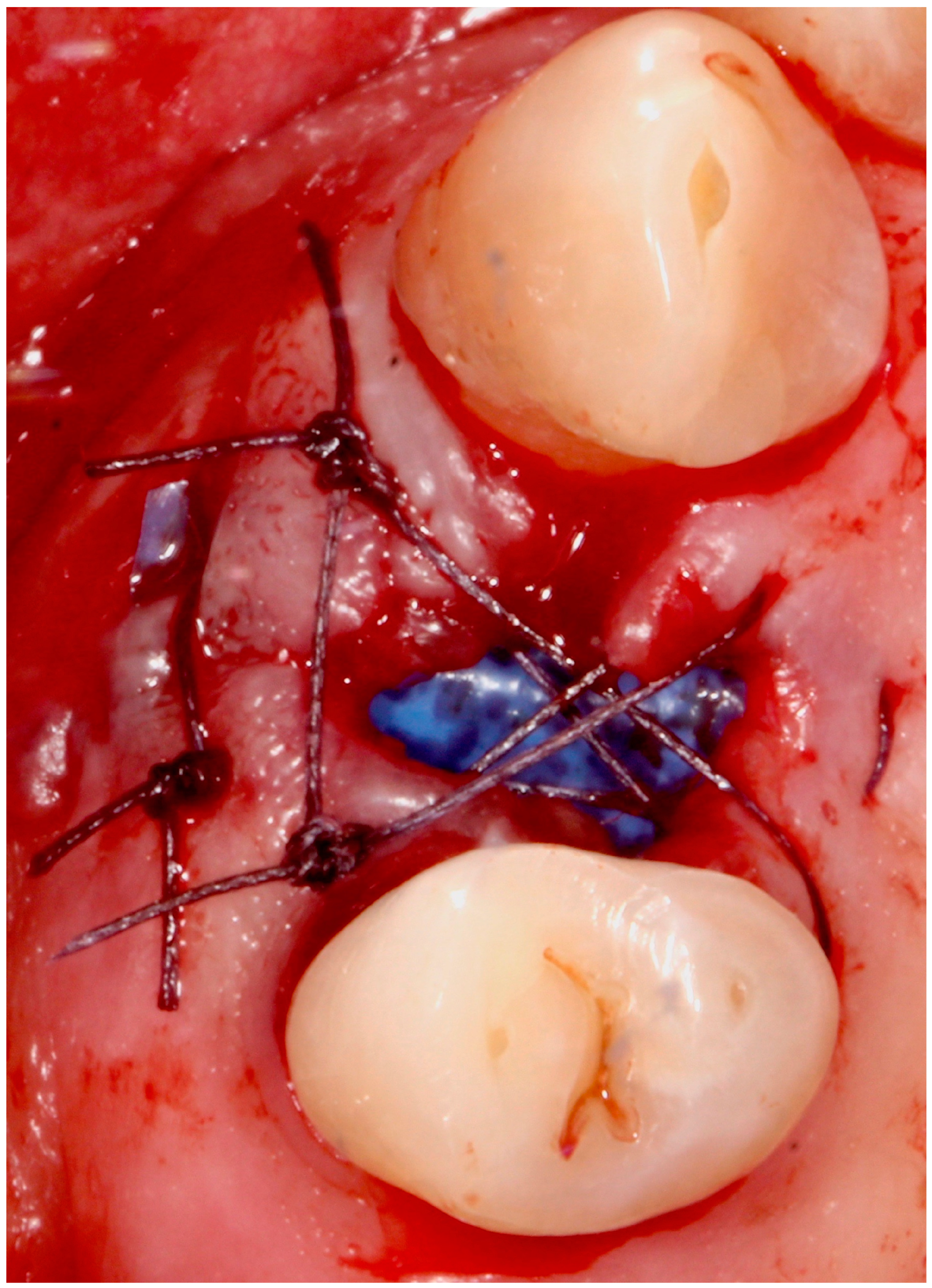 Antibiotics 09 00110 g004