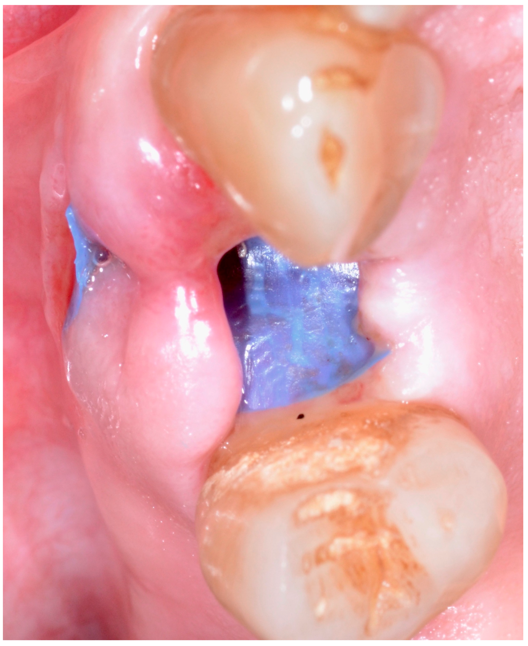 Antibiotics 09 00110 g005