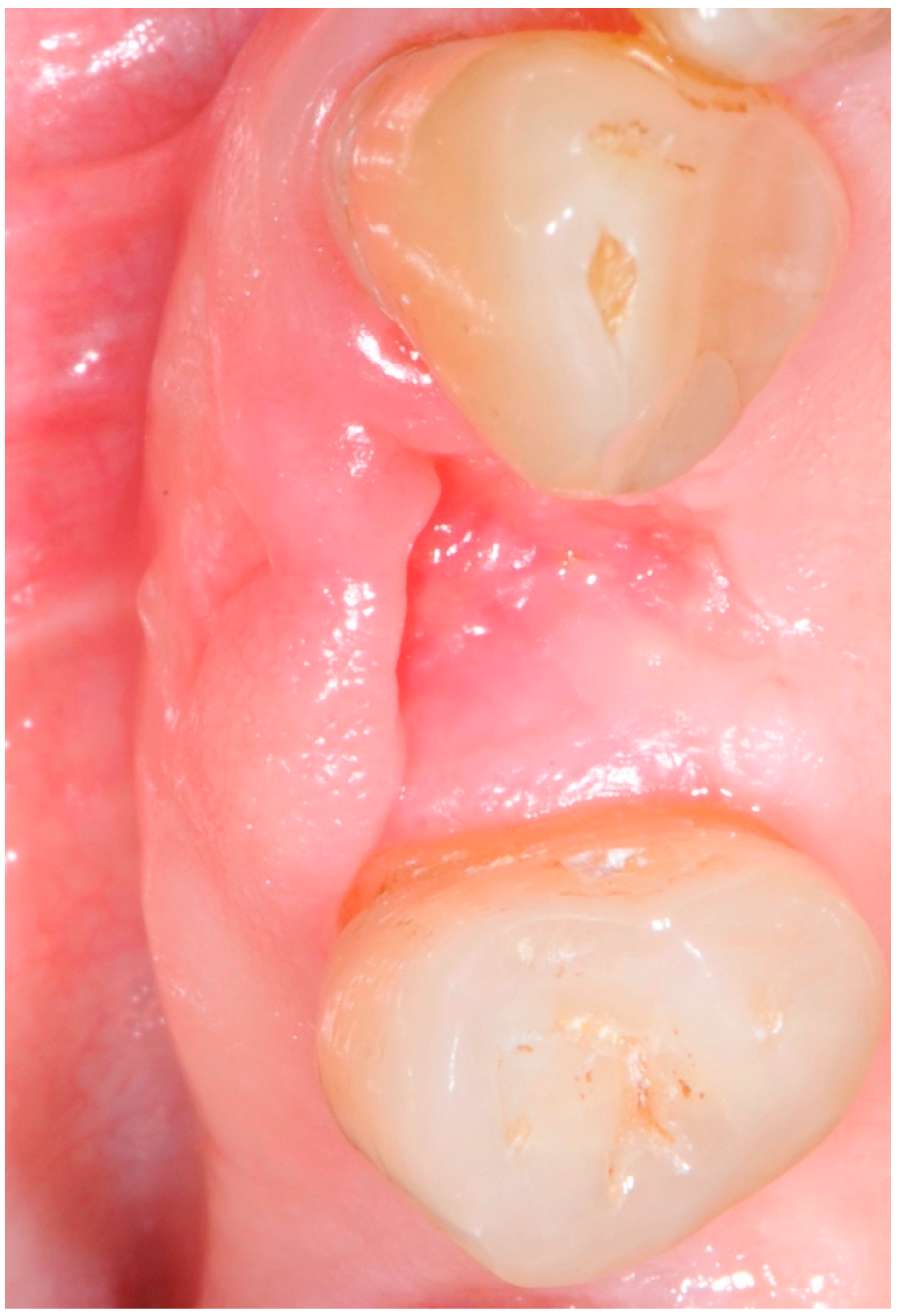 Antibiotics 09 00110 g006