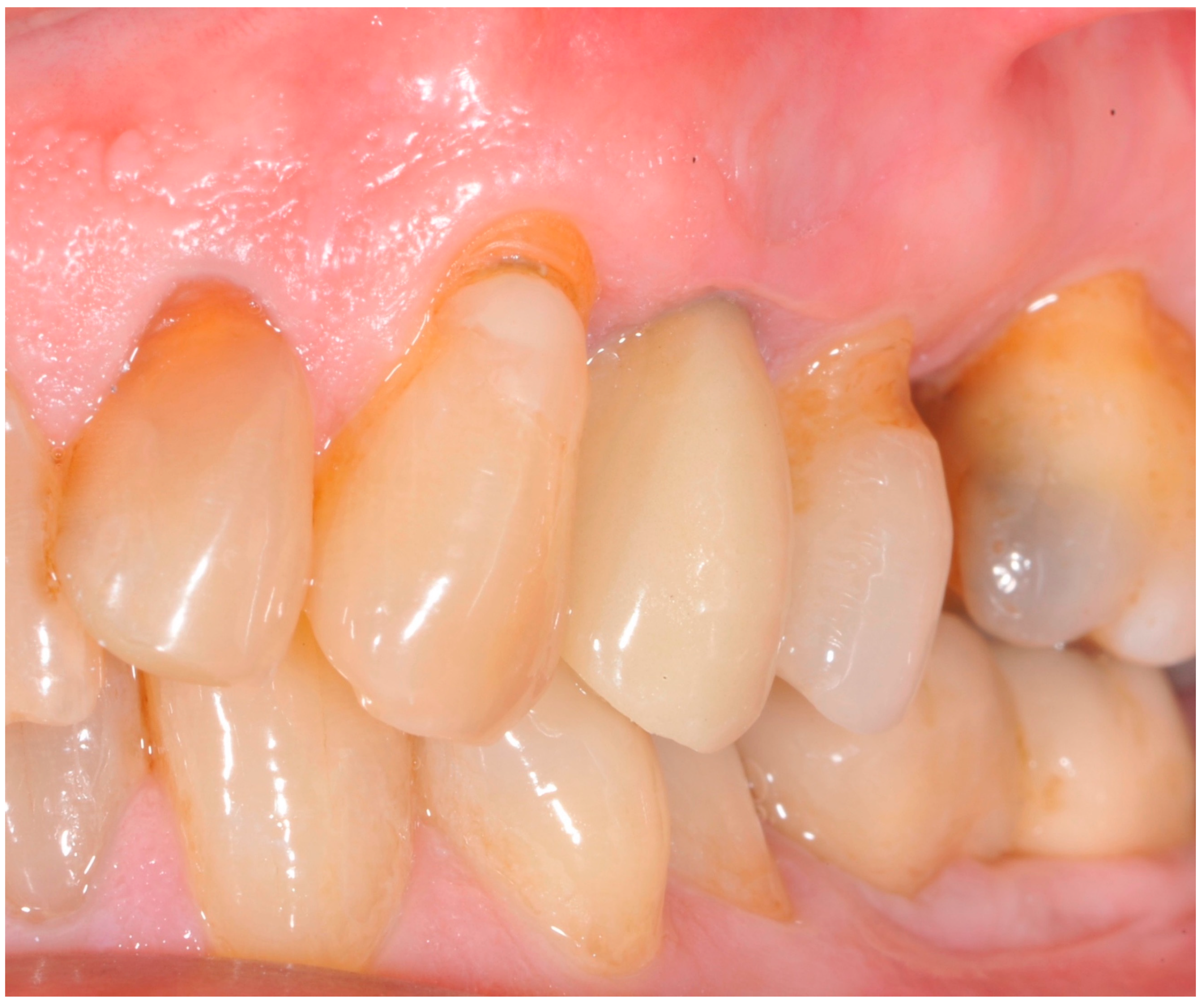 Antibiotics 09 00110 g010