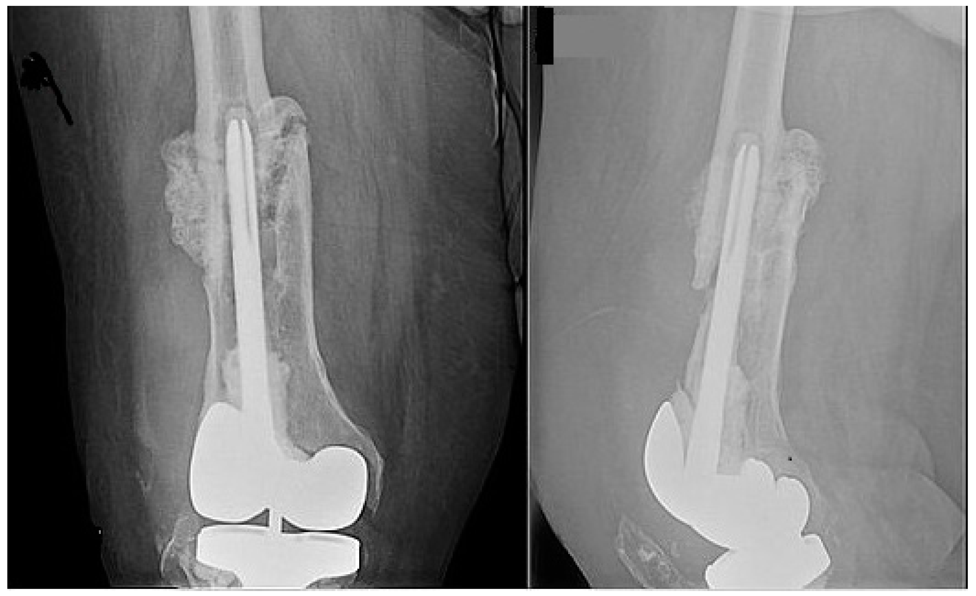 Antibiotics 09 00241 g001 Antibiotics 09 00241 g001