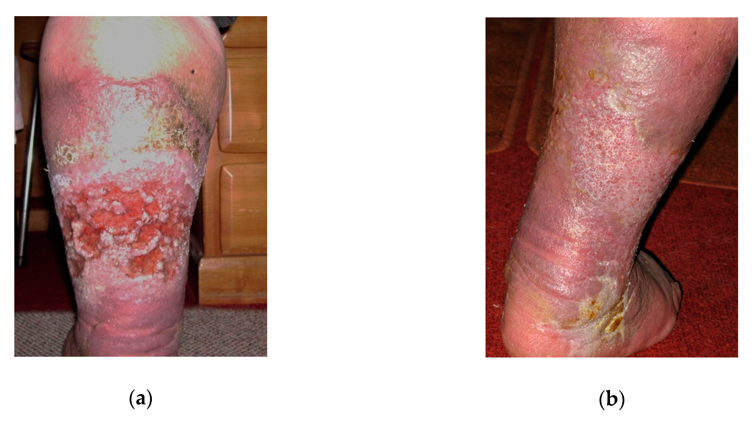 Antibiotics 09 00529 g001 Antibiotics 09 00529 g001