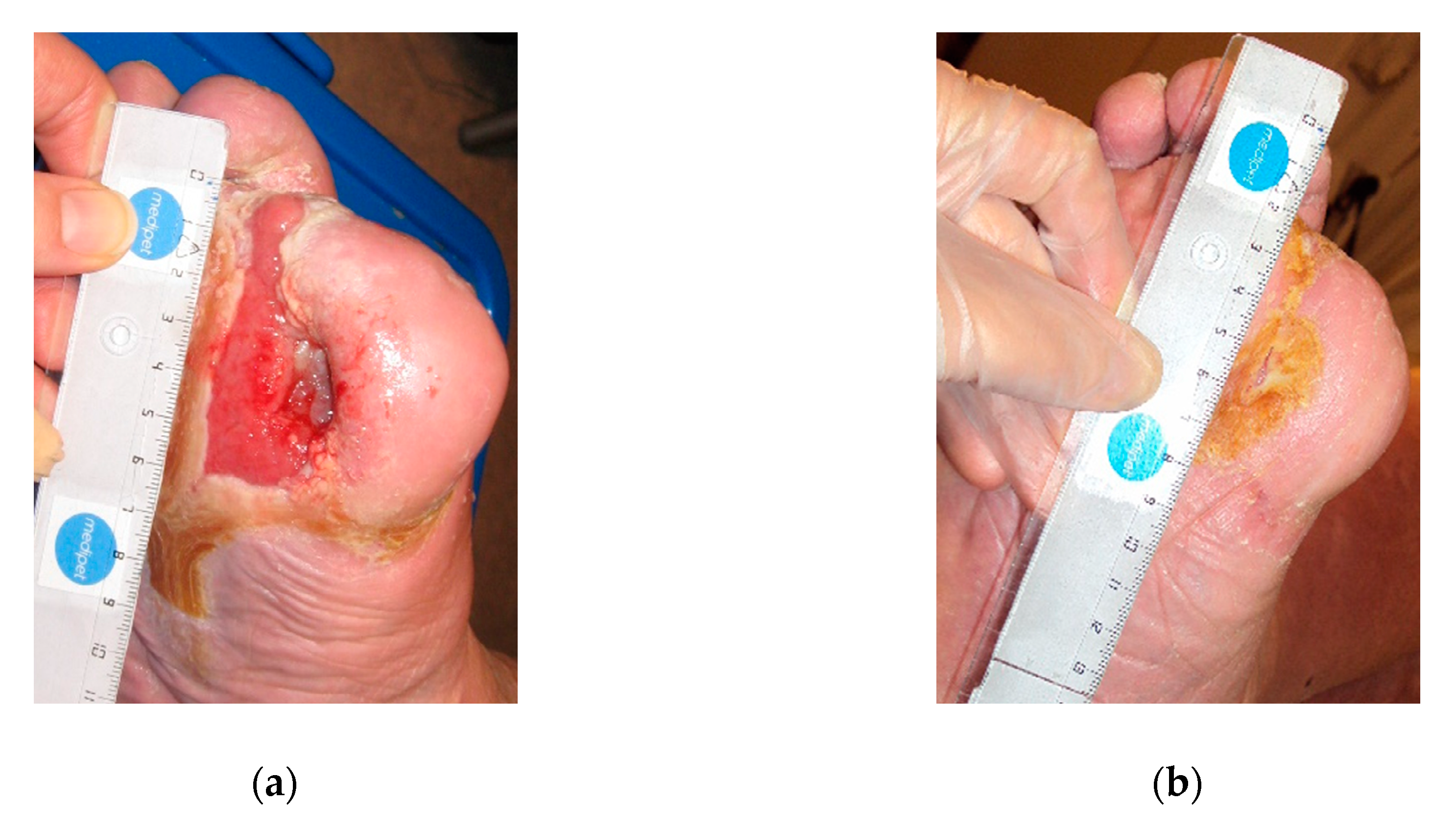 Antibiotics 09 00529 g002 Antibiotics 09 00529 g002