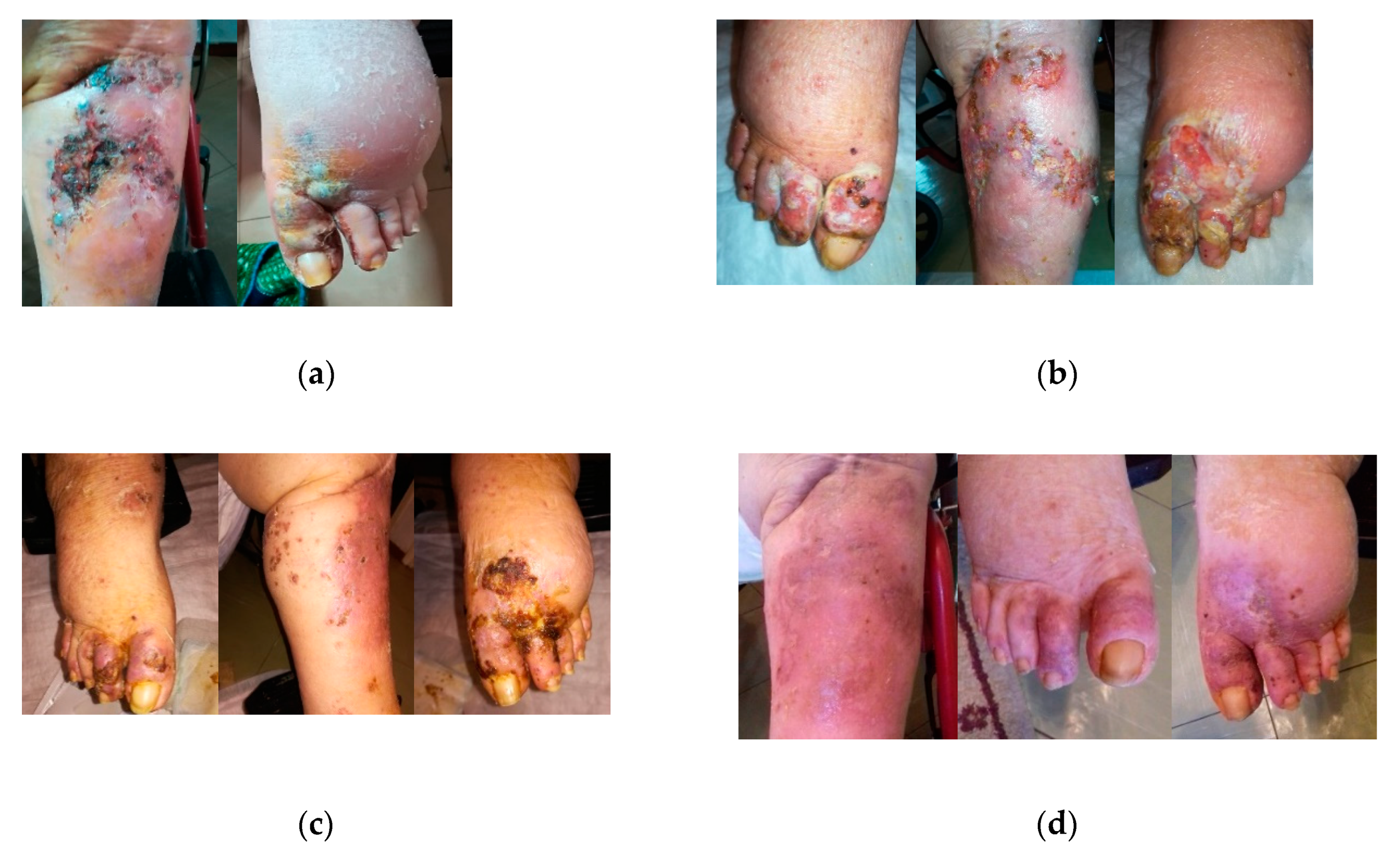 Antibiotics 09 00529 g006 Antibiotics 09 00529 g006