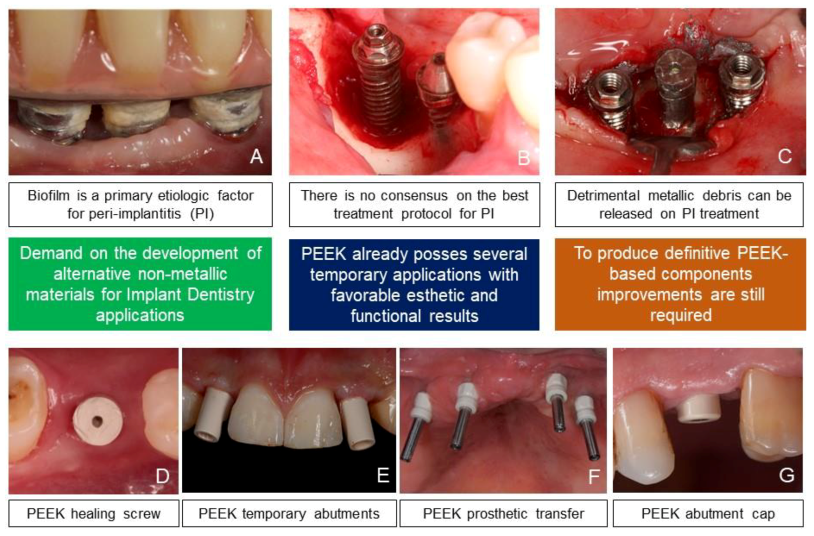 Antibiotics Free Full-text Strategies To Reduce Biofilm Formation In Peek Materials Applied To Implant Dentistrya Comprehensive Review Html