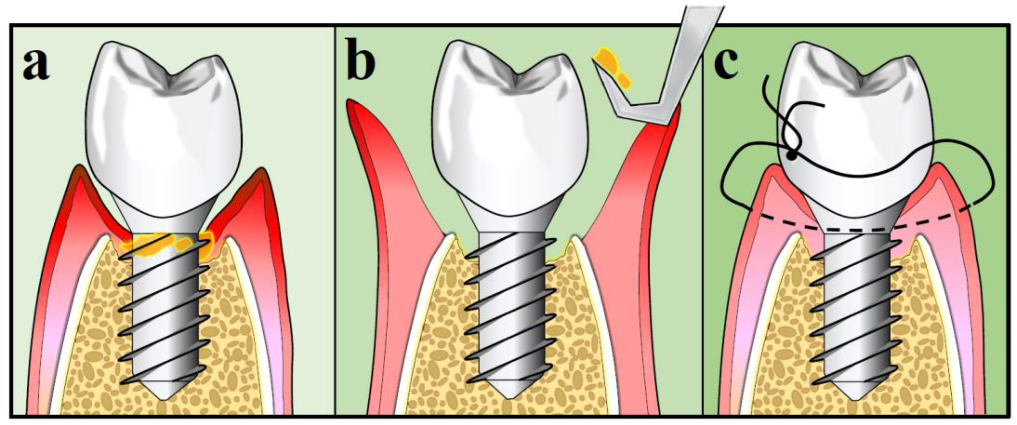 Antibiotics 09 00835 g003 Antibiotics 09 00835 g003