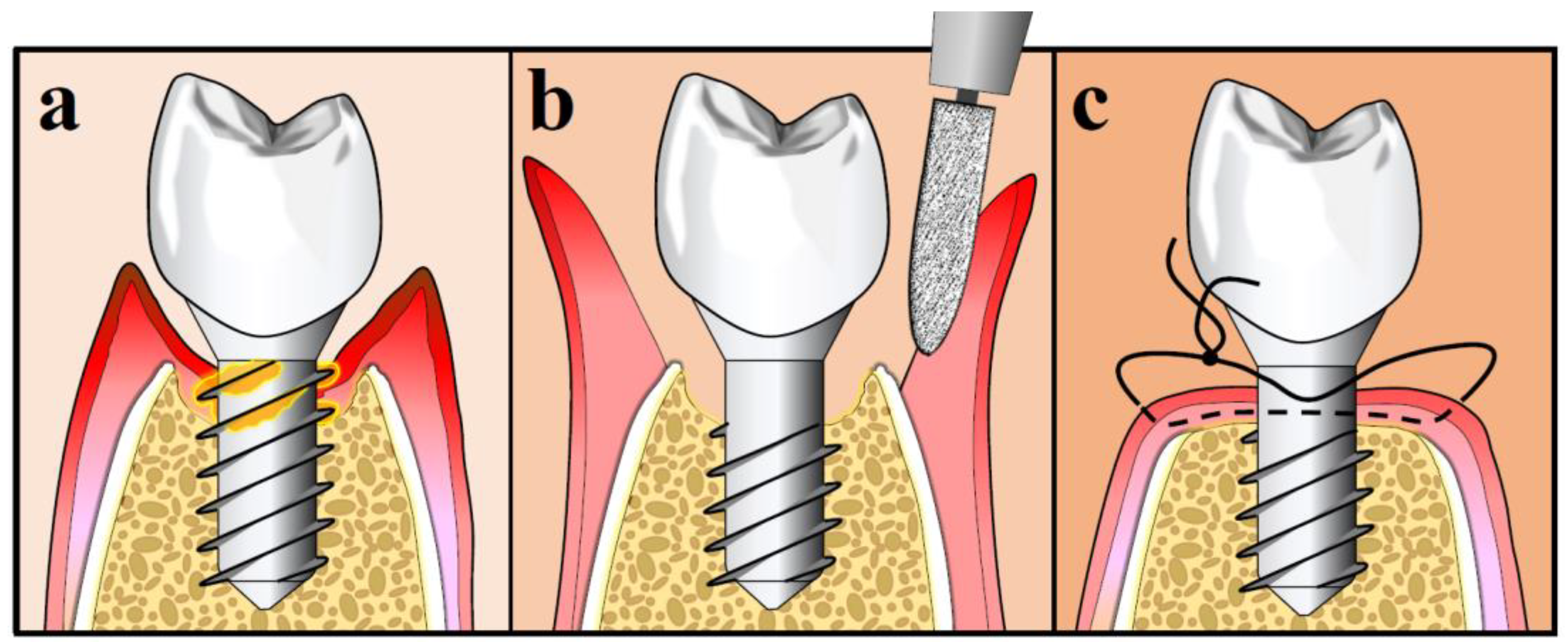 Antibiotics 09 00835 g004 Antibiotics 09 00835 g004