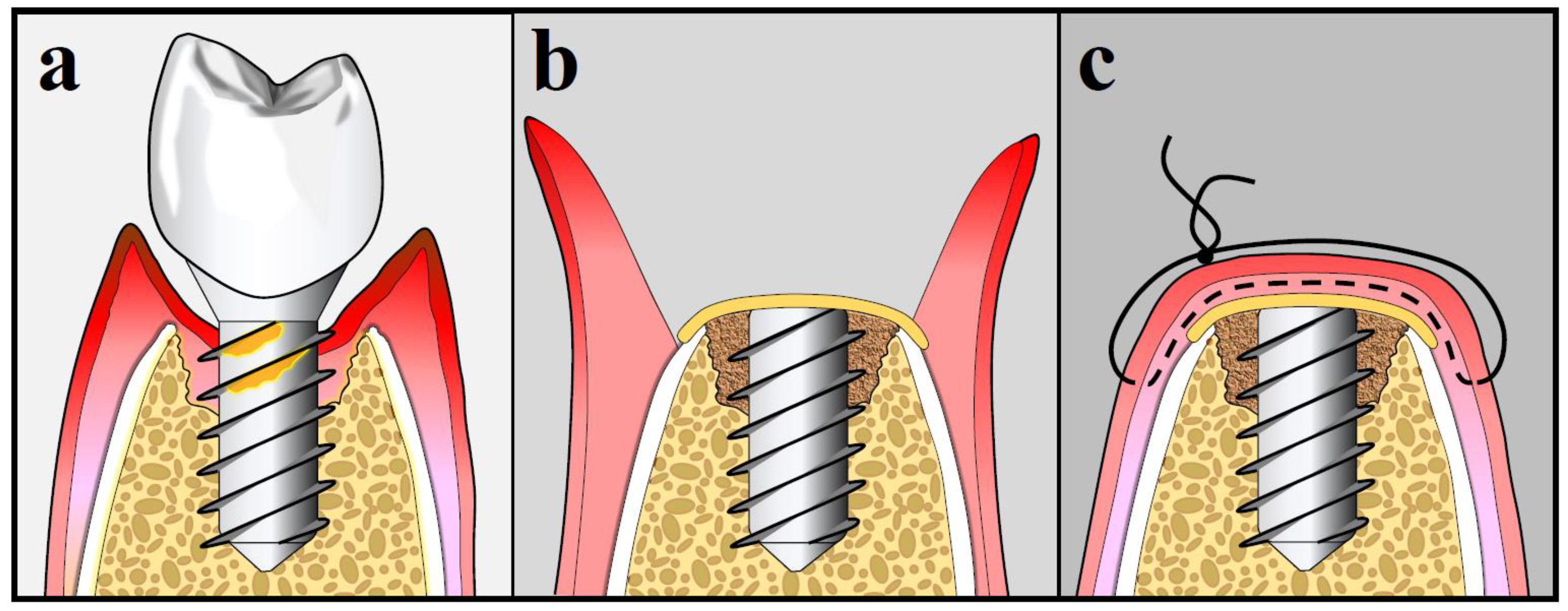 Antibiotics 09 00835 g005 Antibiotics 09 00835 g005
