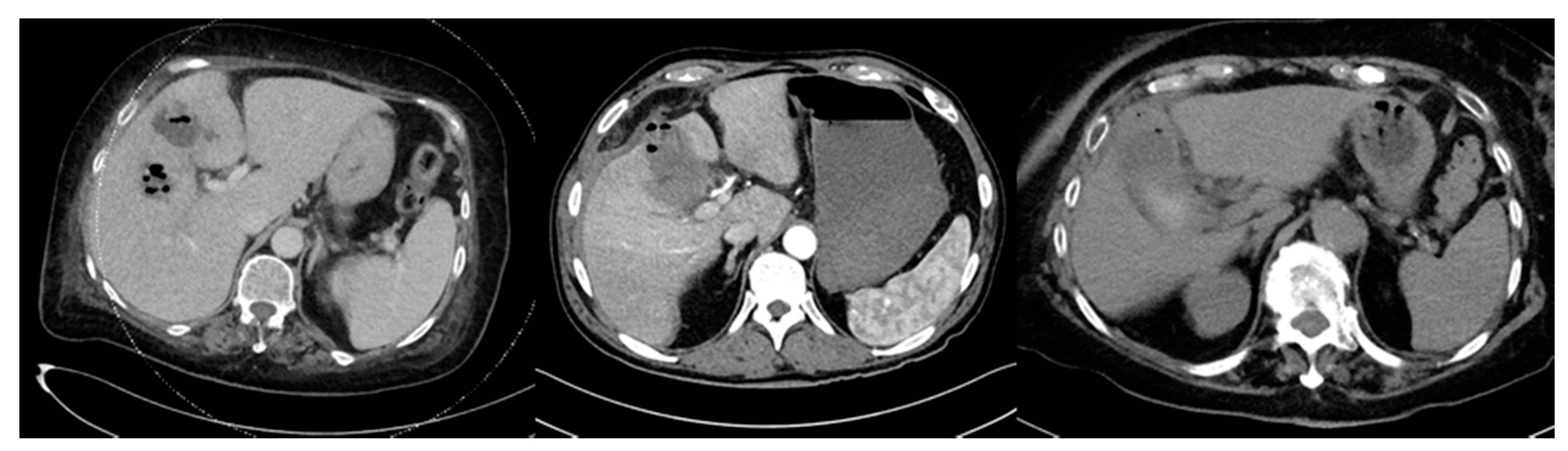 Antibiotics 10 00071 g001 Antibiotics 10 00071 g001