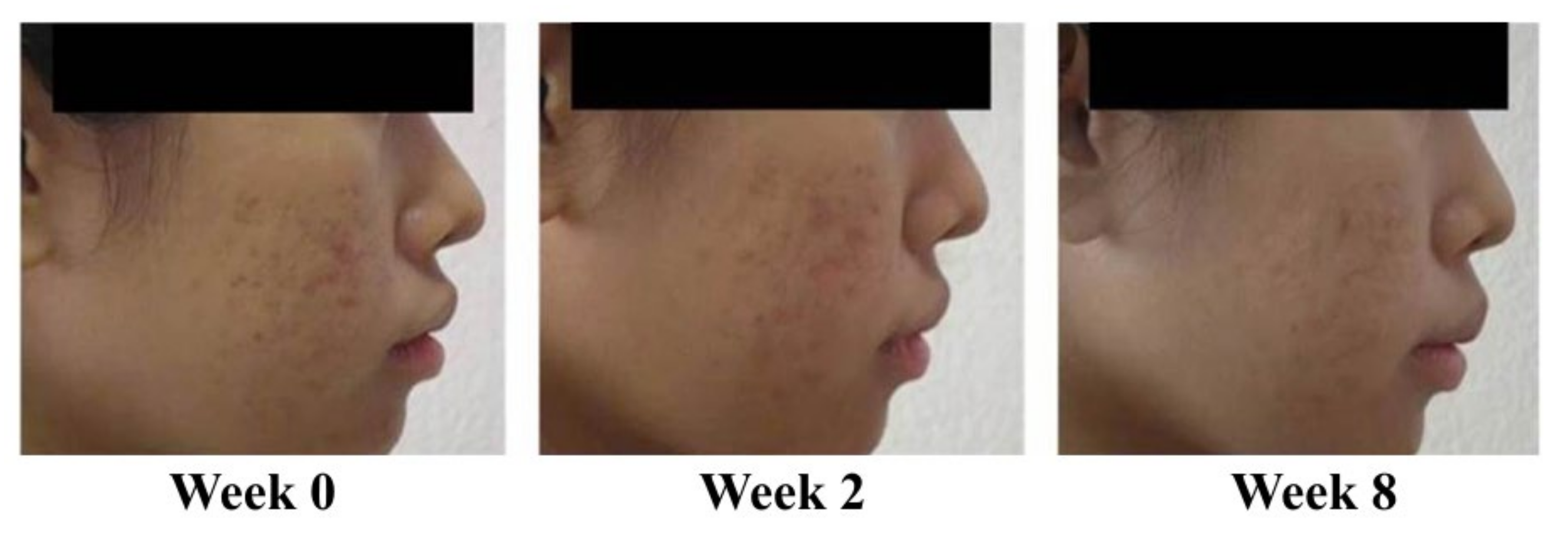 Antibiotics 10 00108 g003