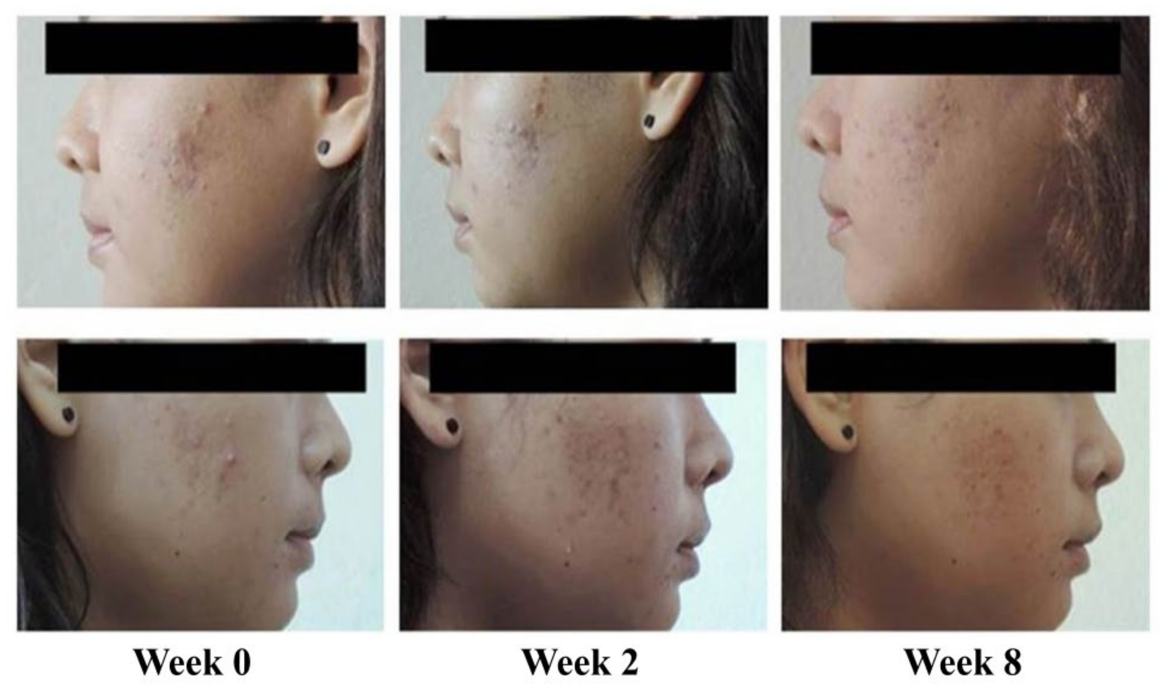 Antibiotics 10 00108 g004