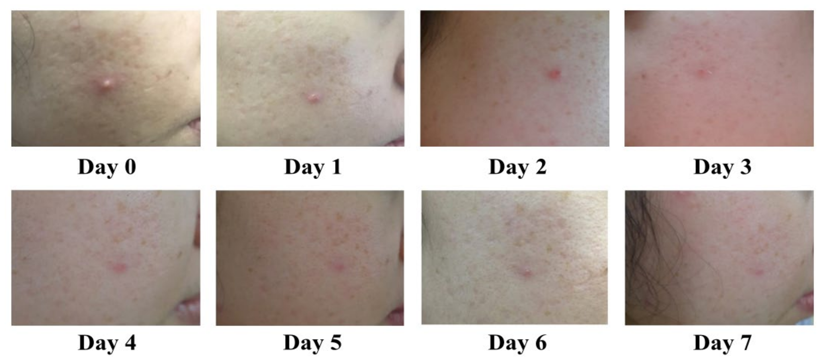 Antibiotics 10 00108 g005