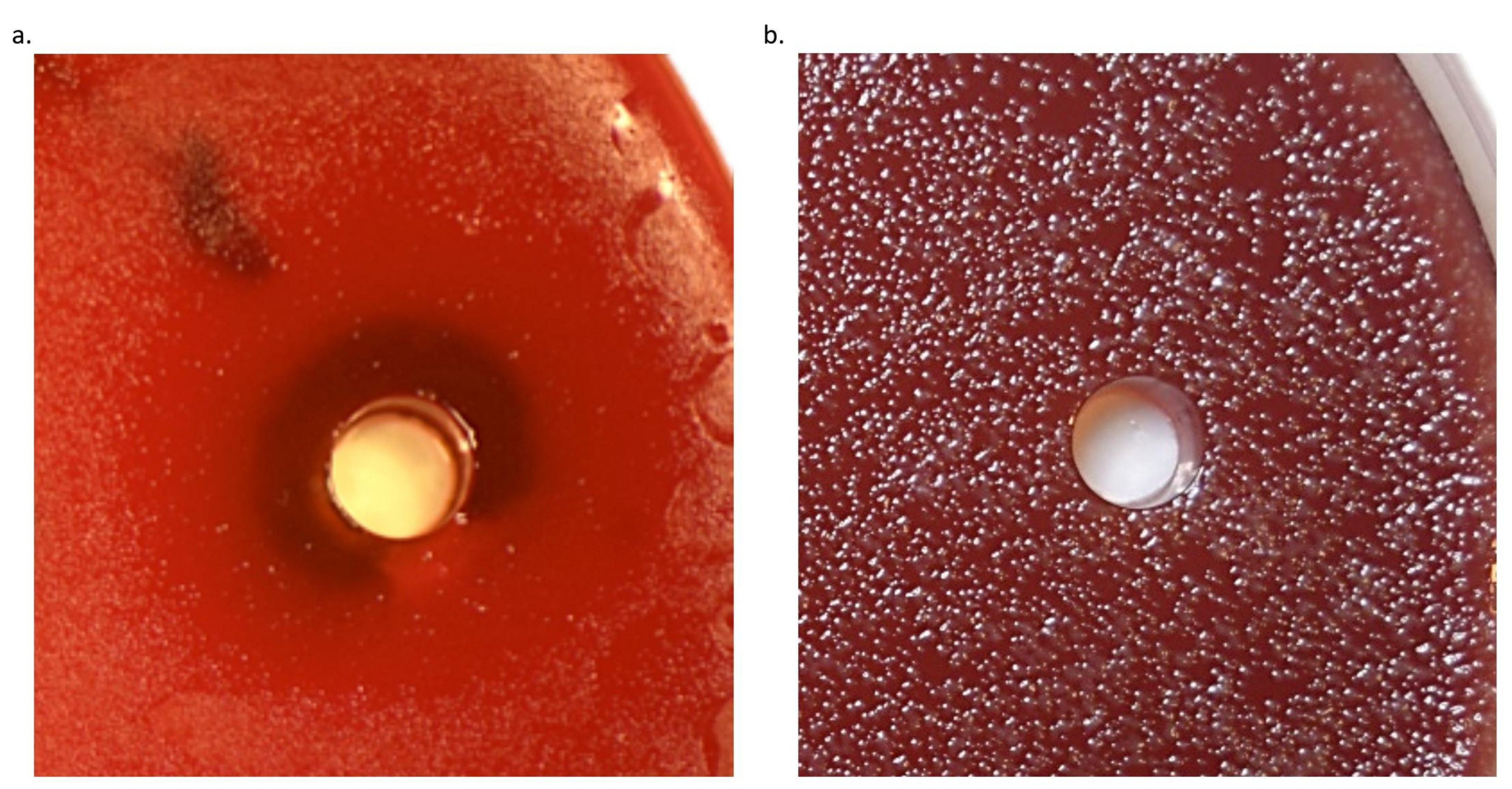 Antibiotics 10 00150 g001 Antibiotics 10 00150 g001