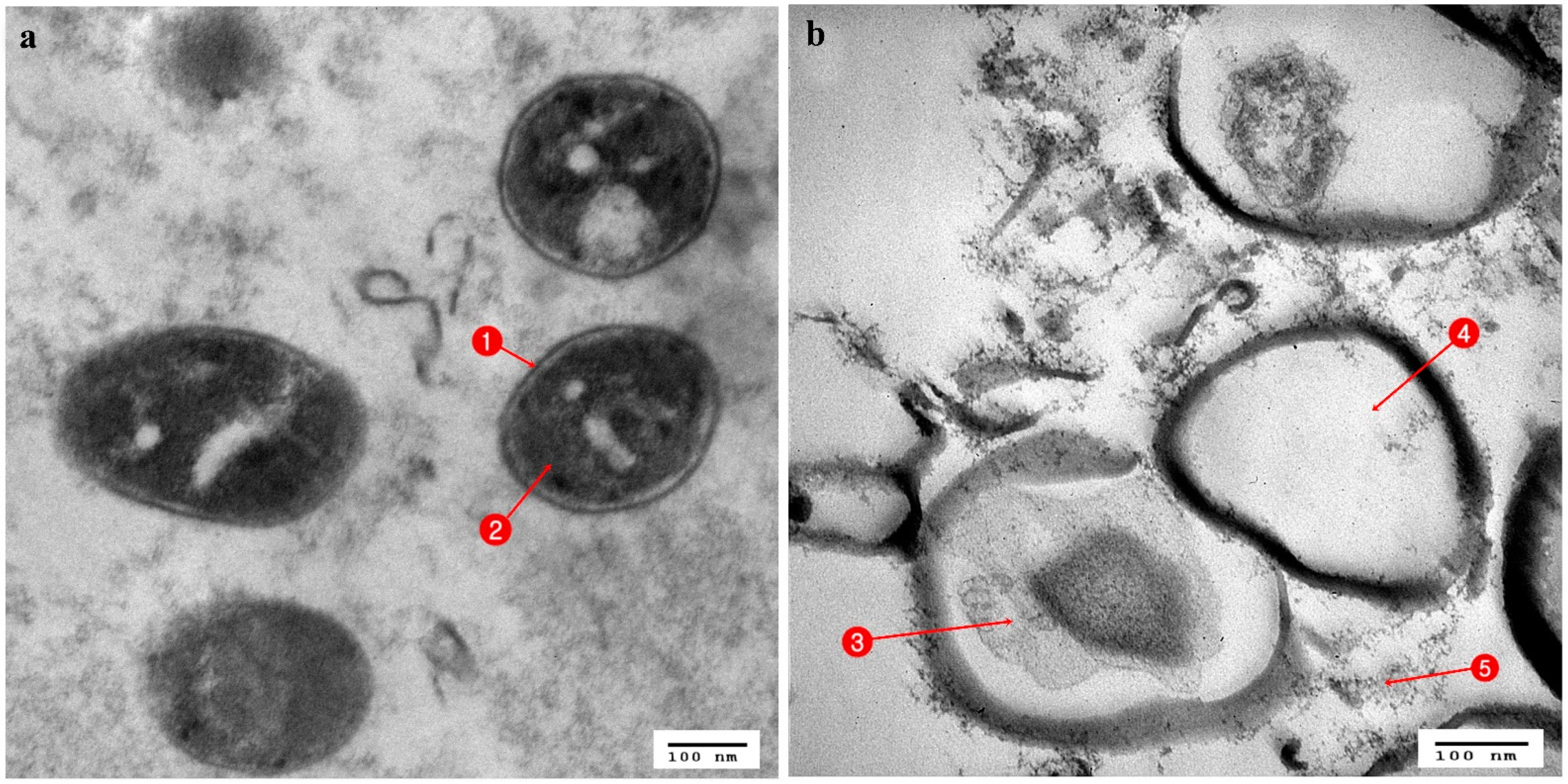 Antibiotics 10 00294 g006 Antibiotics 10 00294 g006