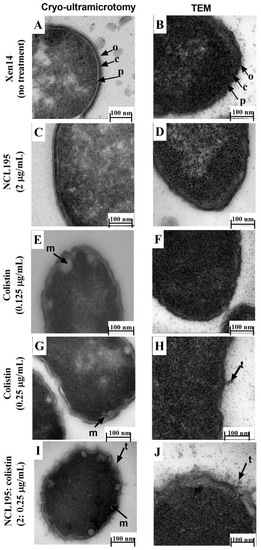 Ruchelle Tratament articular principal