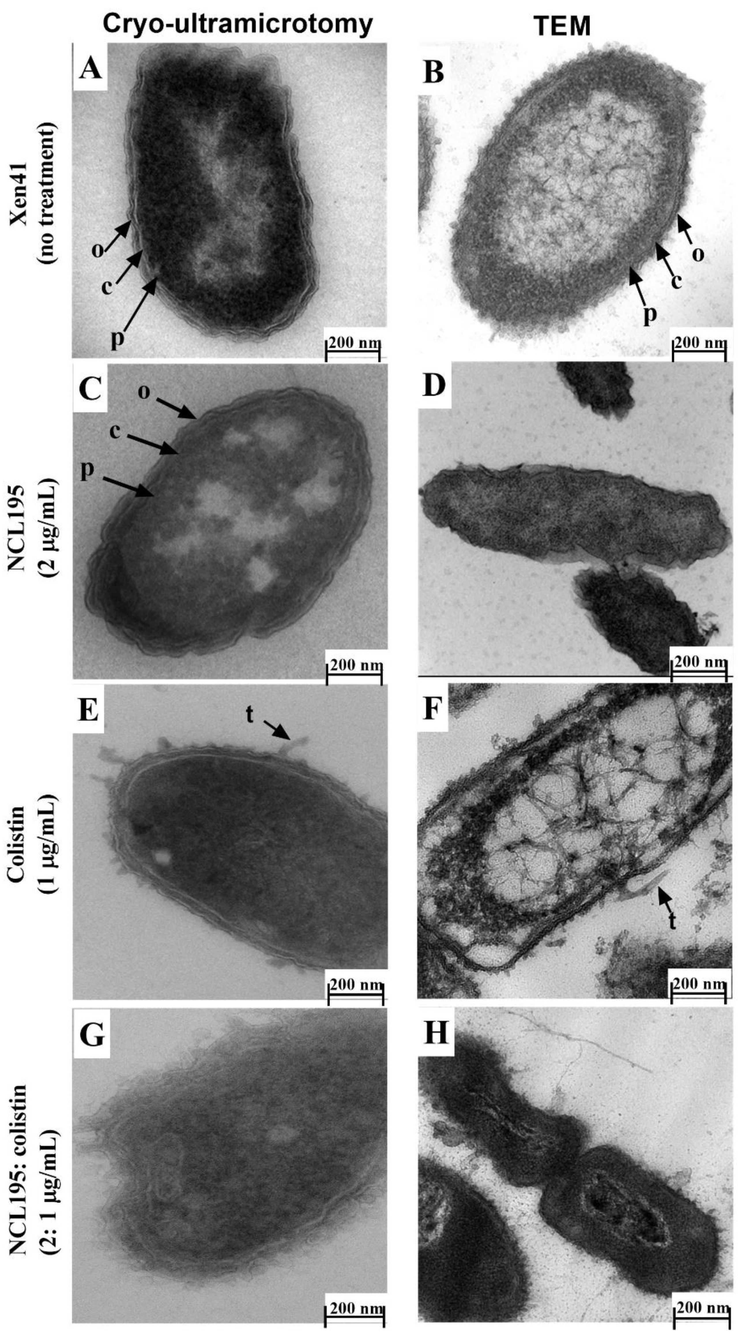 Antibiotics 10 00307 g008 Antibiotics 10 00307 g008