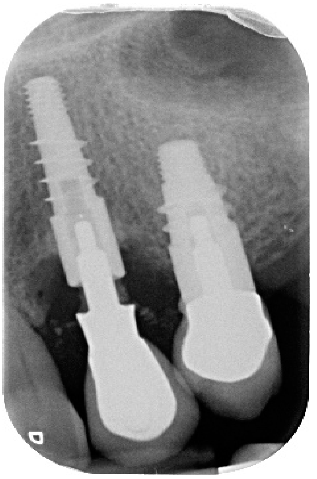 Antibiotics 10 00512 g001 Antibiotics 10 00512 g001