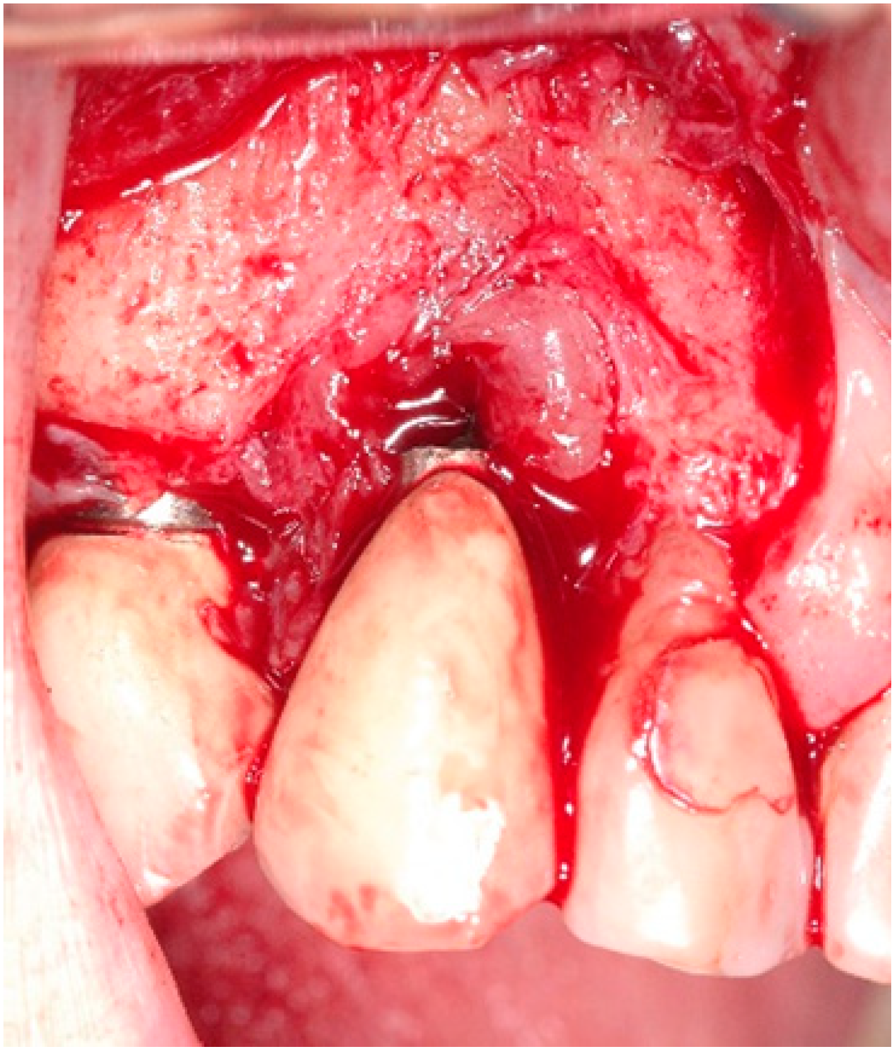 Antibiotics 10 00512 g002 Antibiotics 10 00512 g002