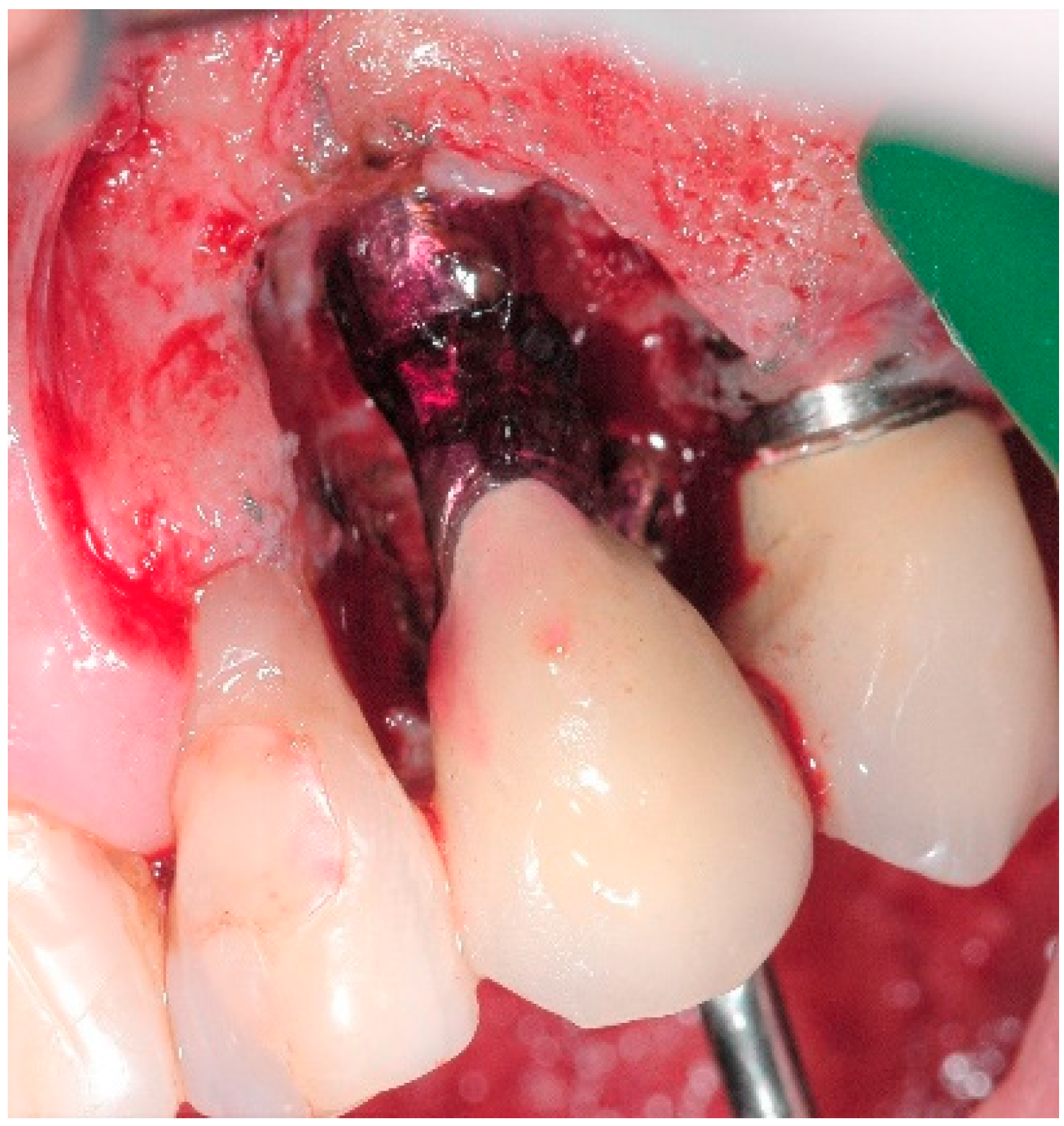 Antibiotics 10 00512 g004 Antibiotics 10 00512 g004